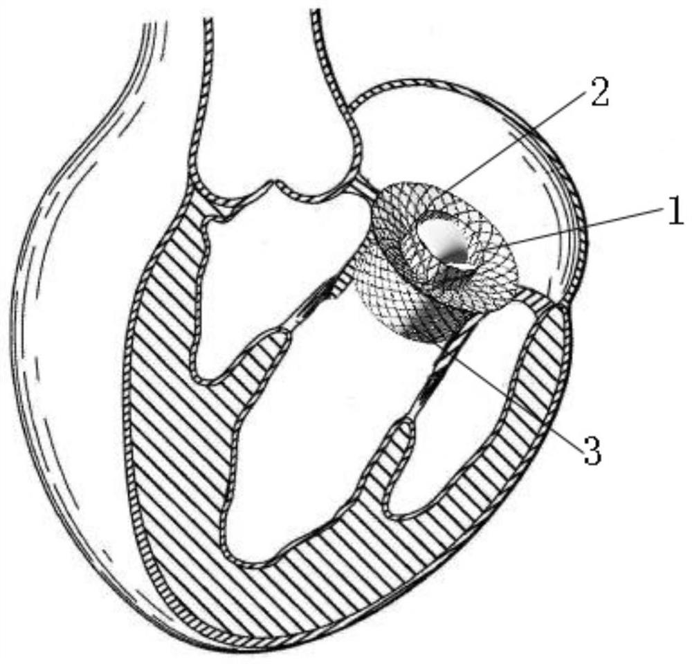 Artificial heart valve