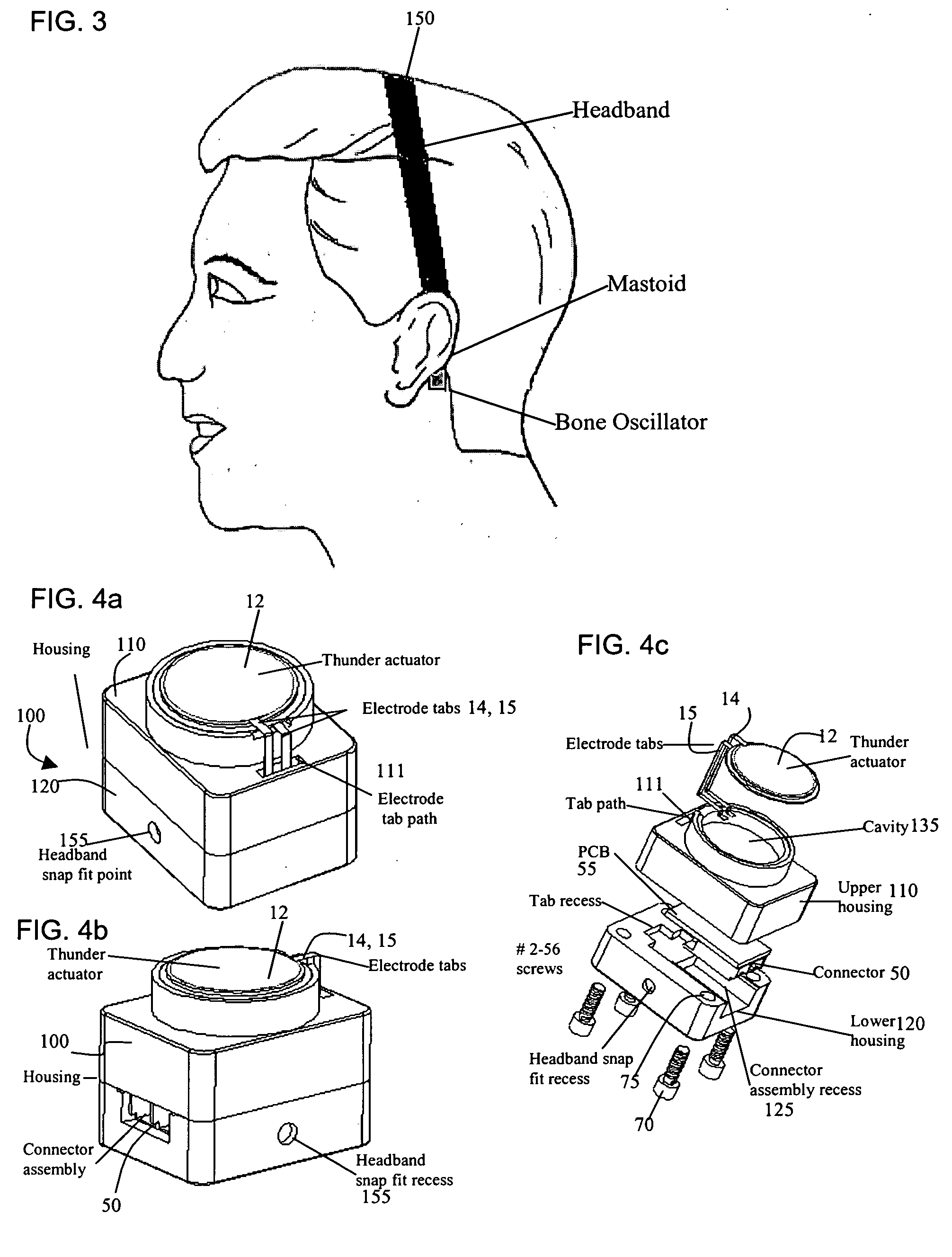 Bone-conduction hearing-aid transducer having improved frequency response