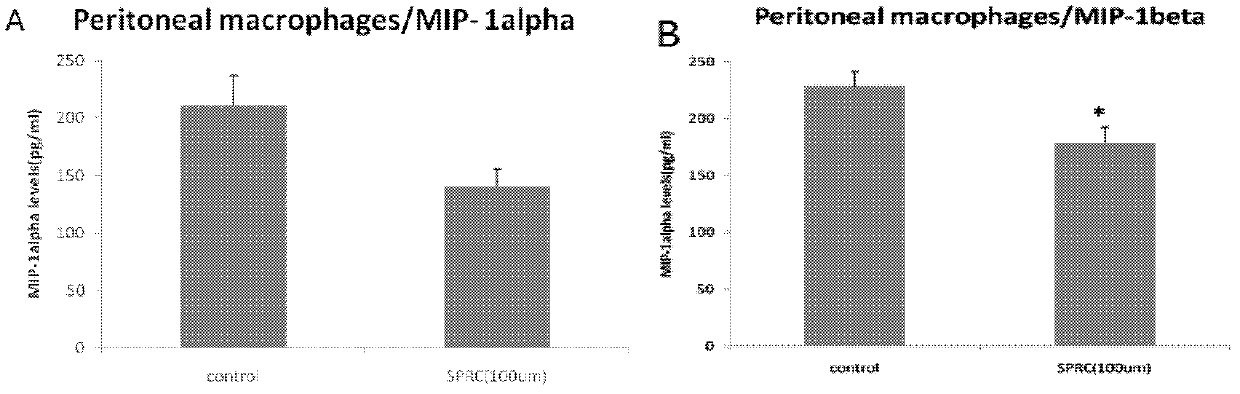 Use of propargyl cysteine and analogue thereof in preparation of drug for treating immunity-related inflammation diseases