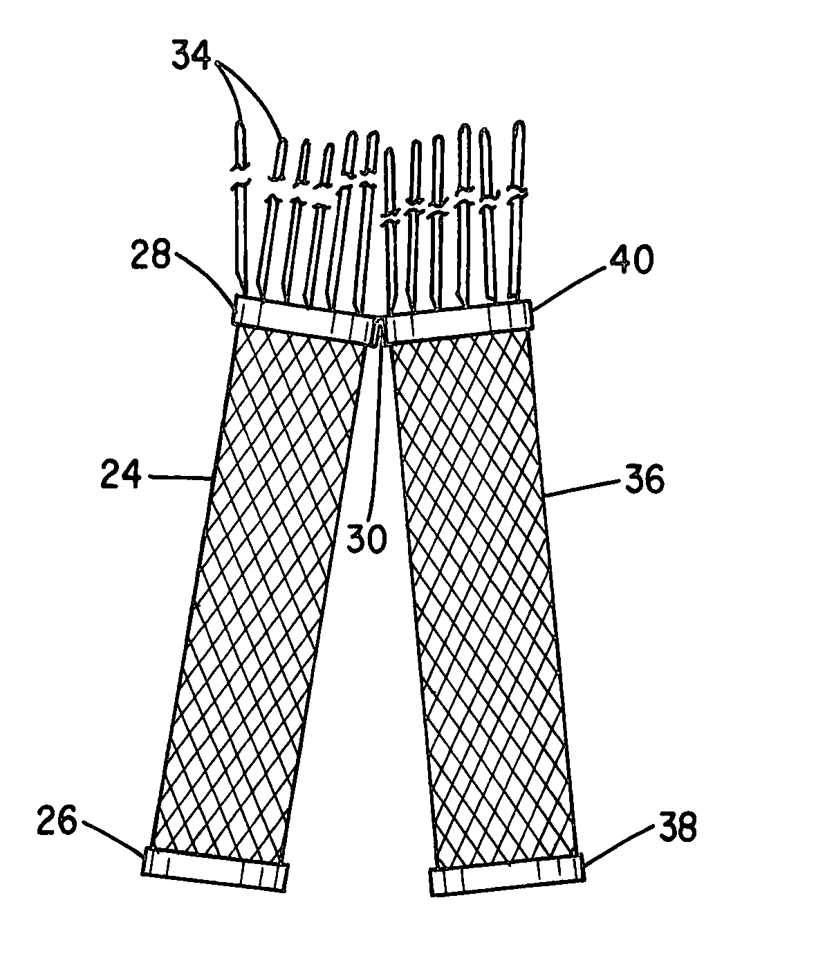 Branched stent/graft and method of fabrication