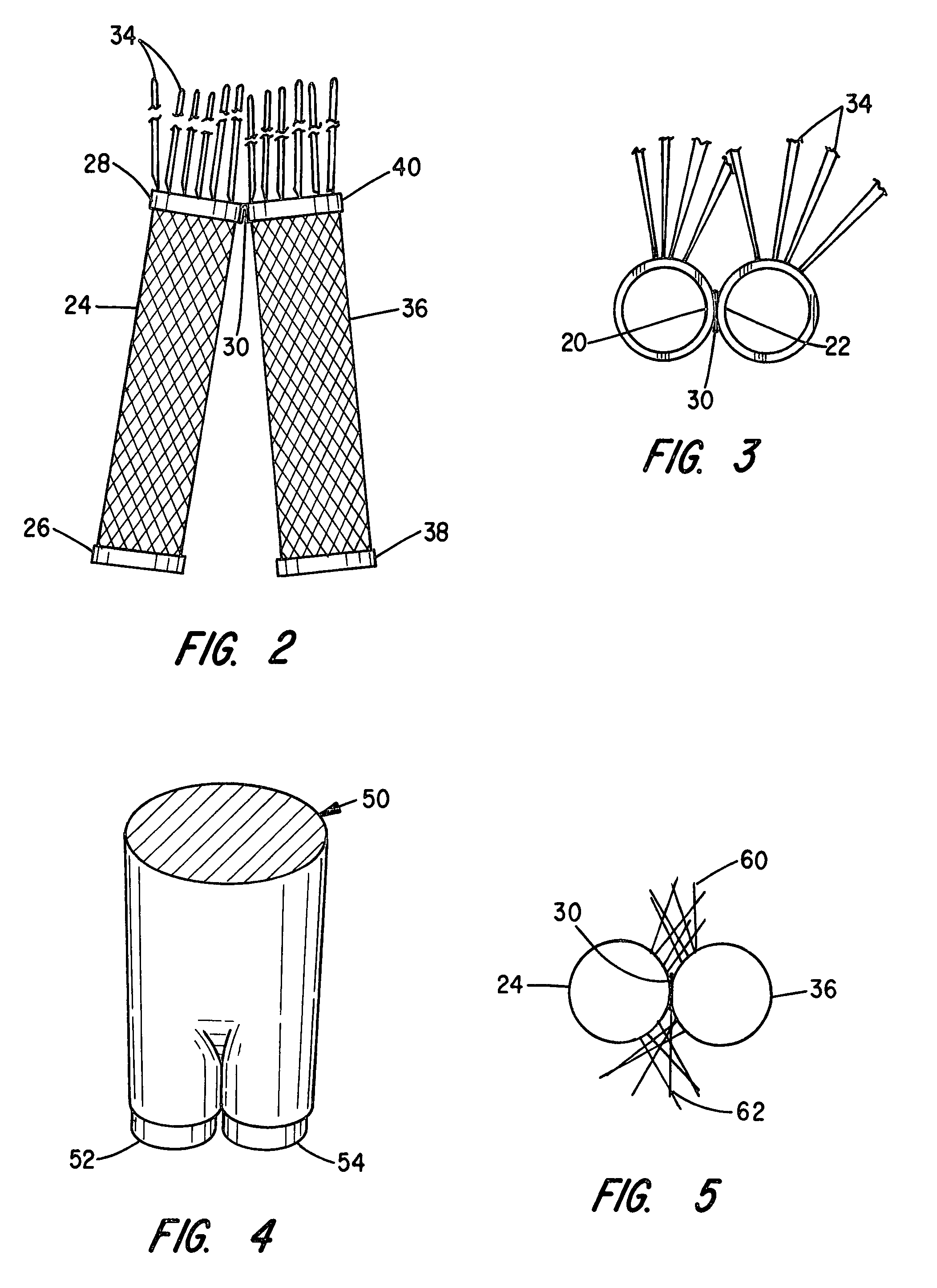 Branched stent/graft and method of fabrication