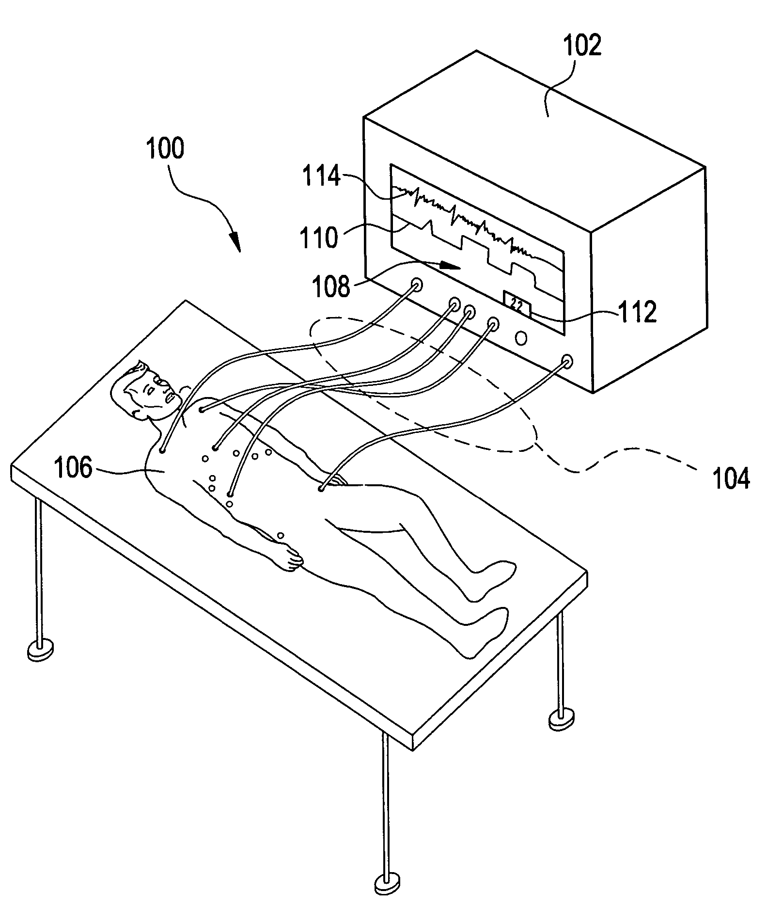 Respiration monitoring system and method