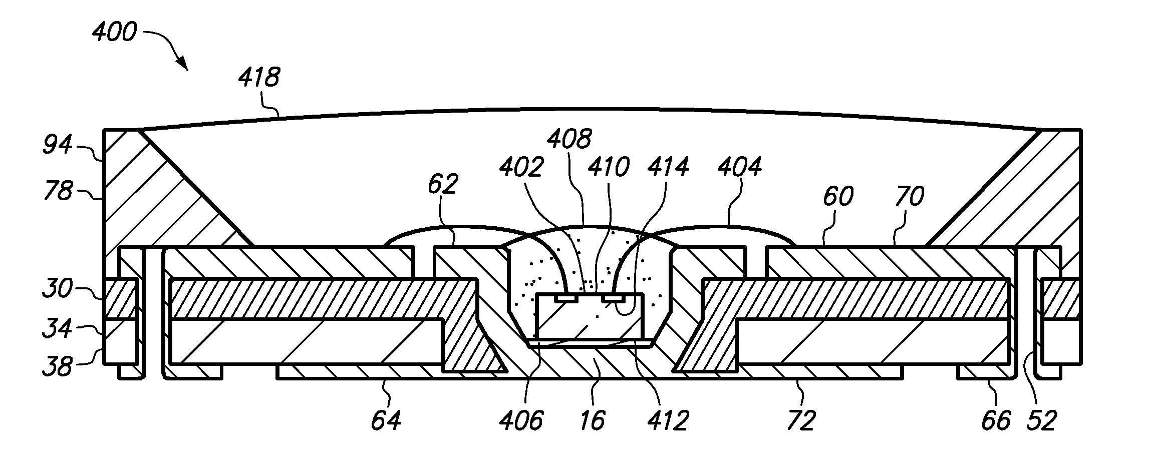 Semiconductor chip assembly with bump/base heat spreader and dual-angle cavity in bump