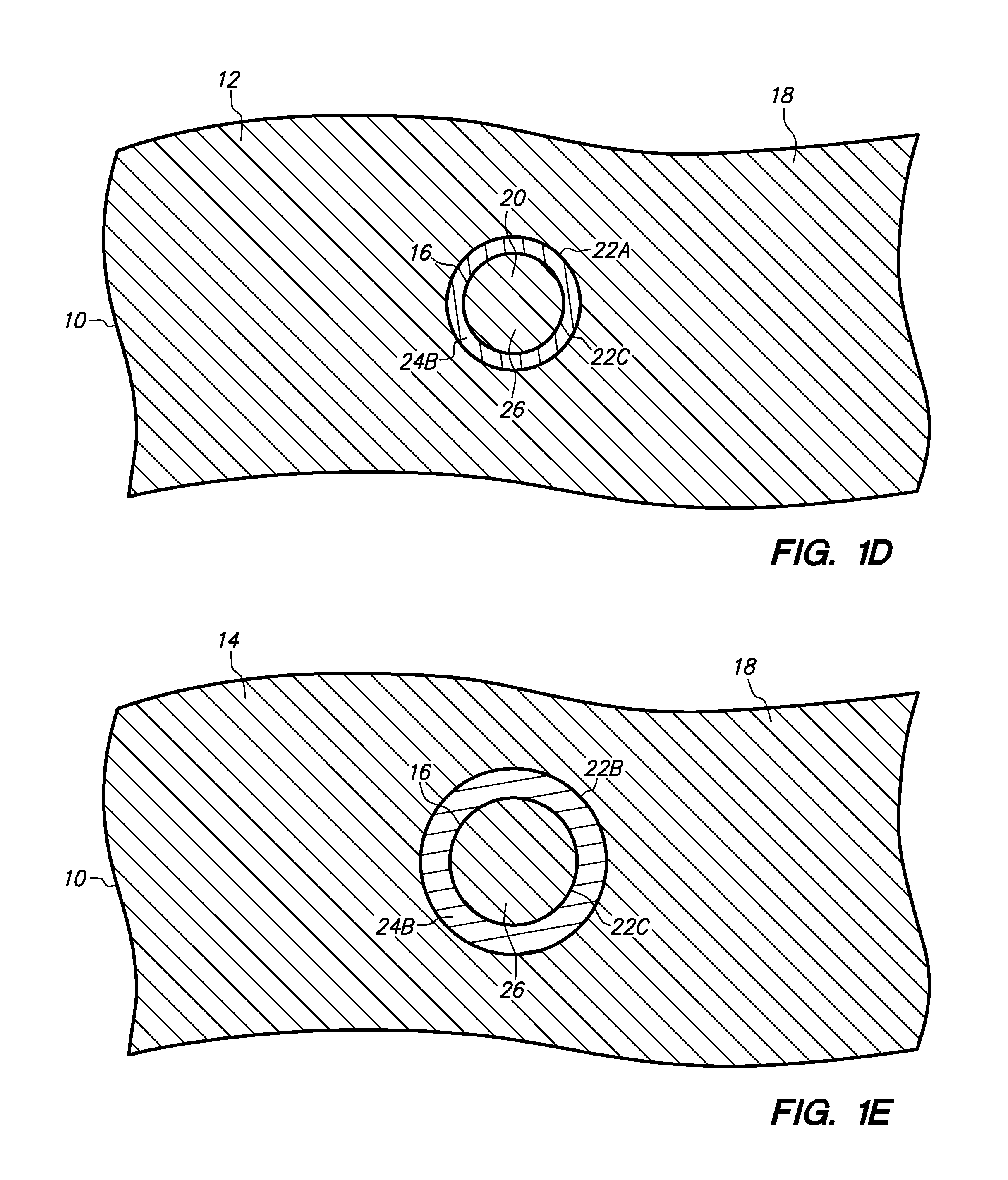 Semiconductor chip assembly with bump/base heat spreader and dual-angle cavity in bump
