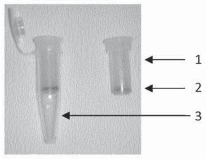 Method for diagnosing haemostasis disorders using activated charcoal