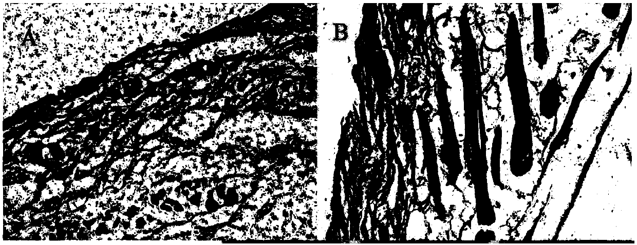 Method for promoting hair regeneration based on plasmas