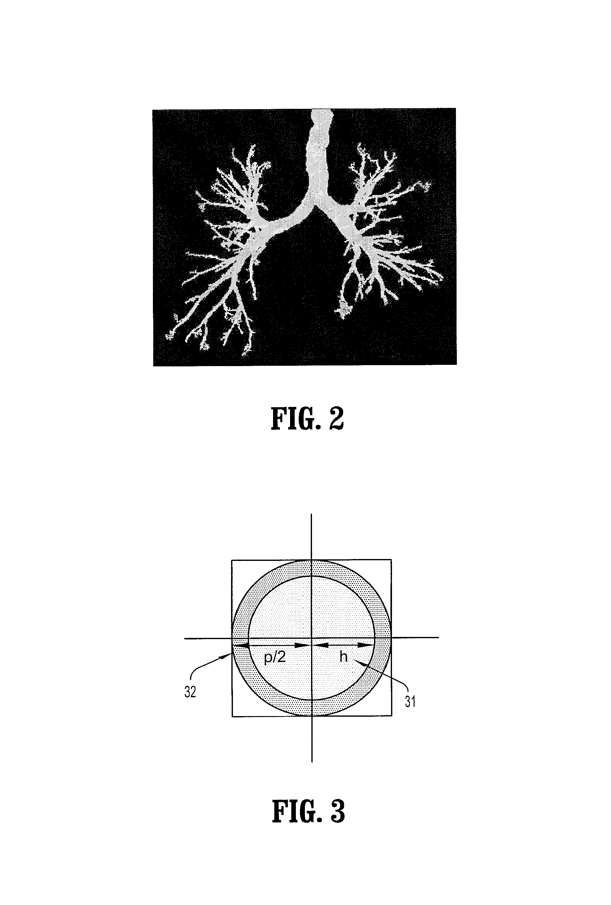 System and method for automated detection of mucus plugs within bronchial tree in MSCT images