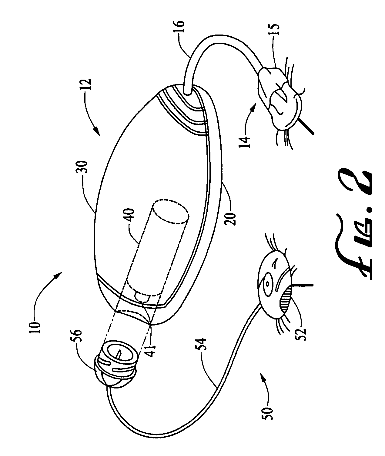Systems and methods allowing for reservoir filling and infusion medium delivery