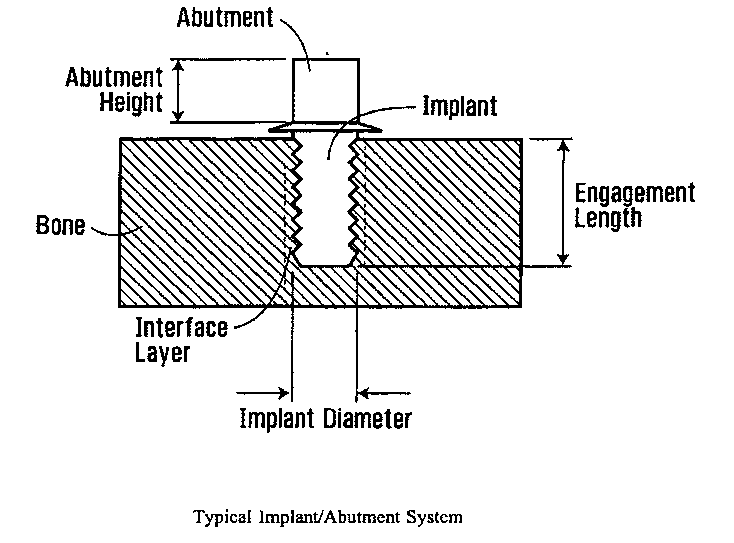 Apparatus and method for assessing percutaneous implant integrity