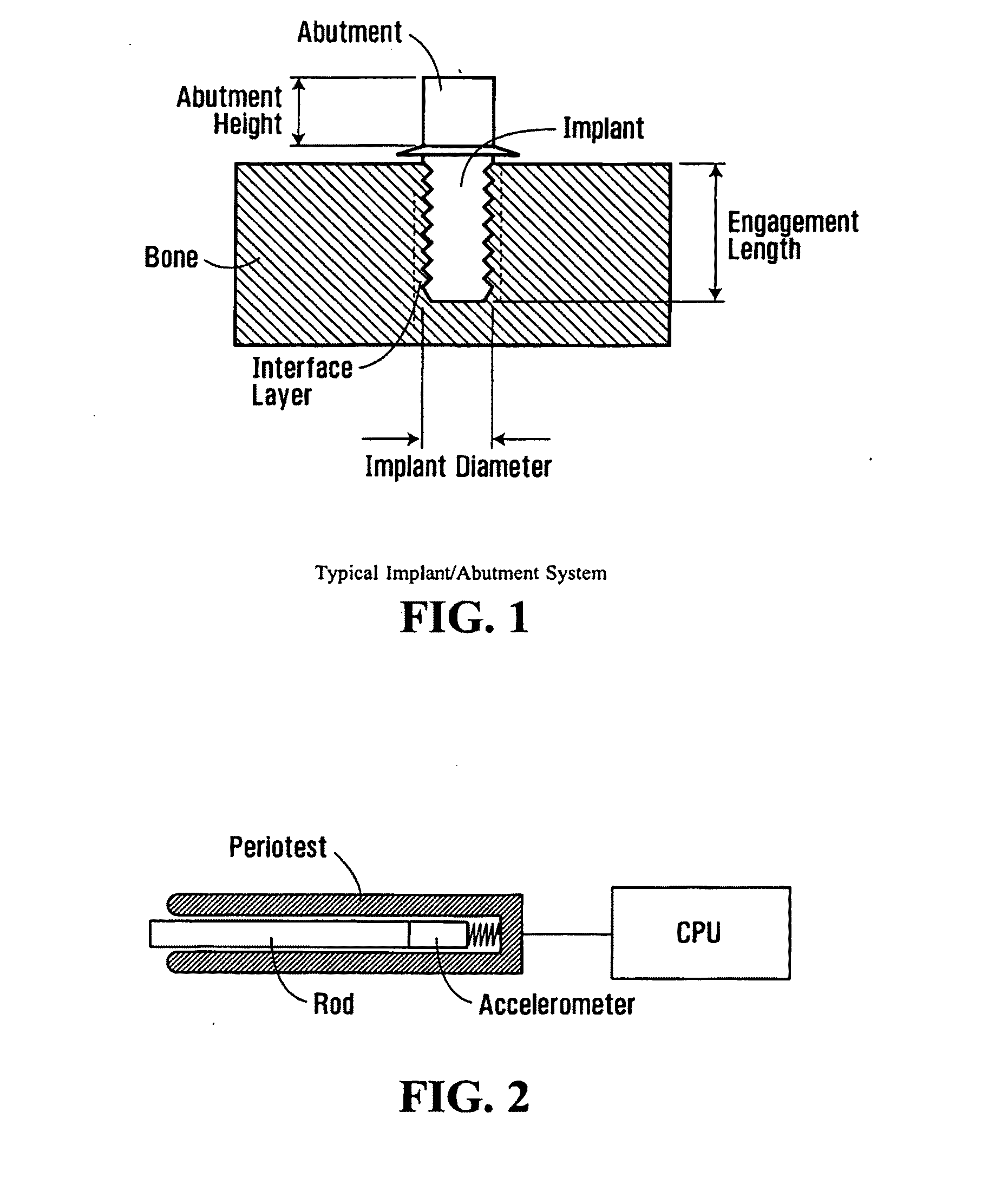 Apparatus and method for assessing percutaneous implant integrity