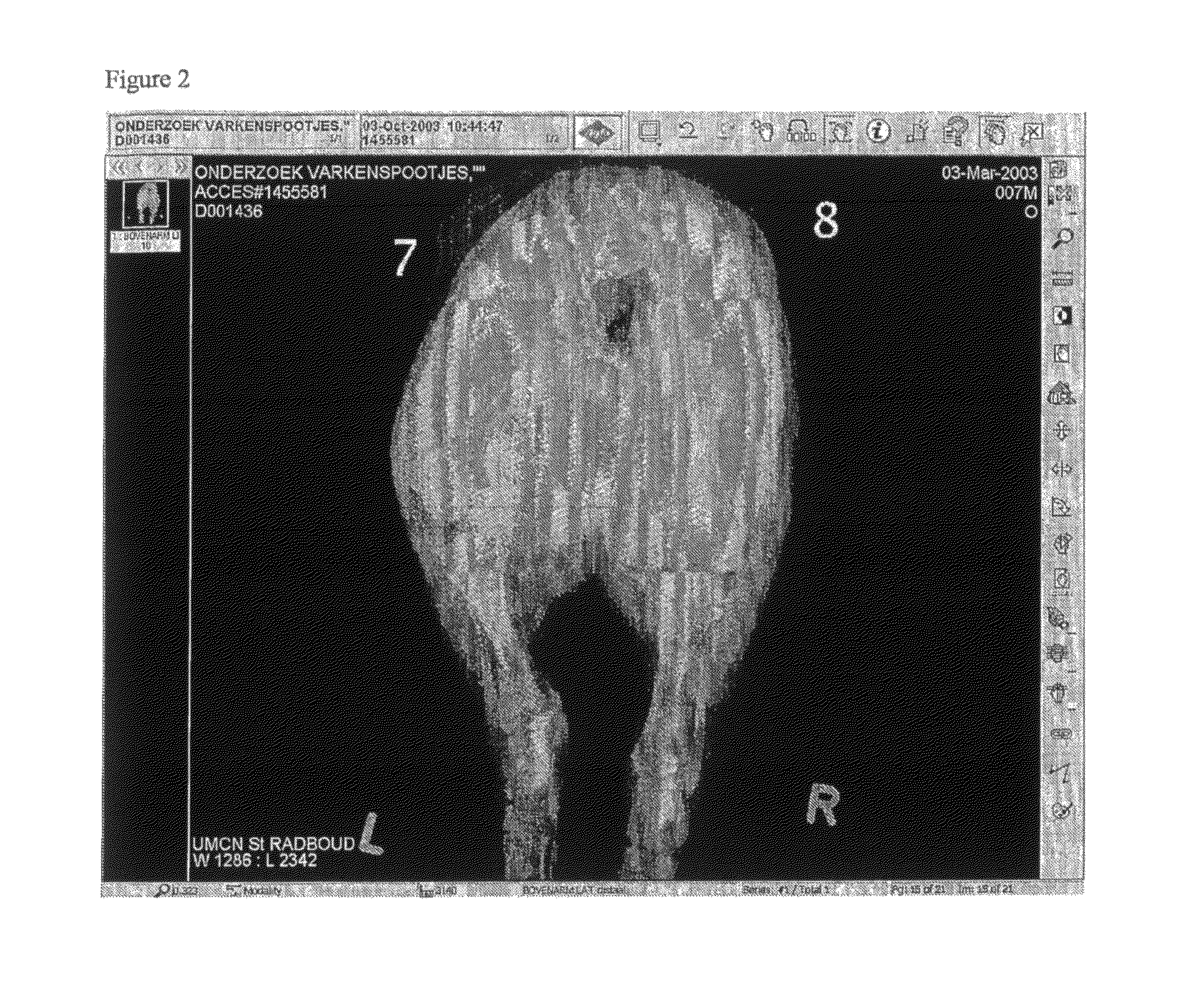 X-ray visible drug delivery device