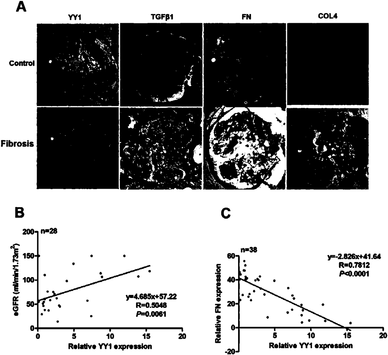 Application of Eudesmin in preparation of drugs for preventing or curing renal fibrosis