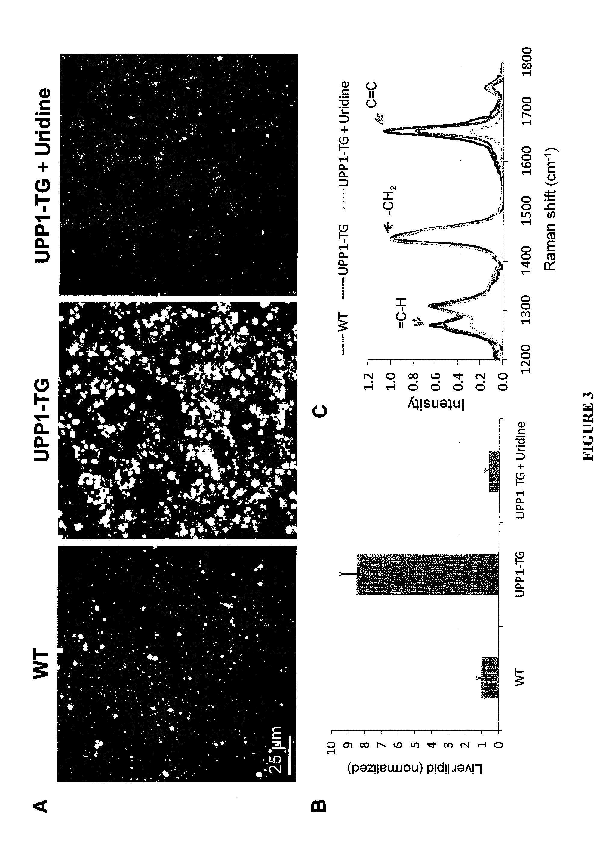 Methods for Treating Fatty Liver Disease