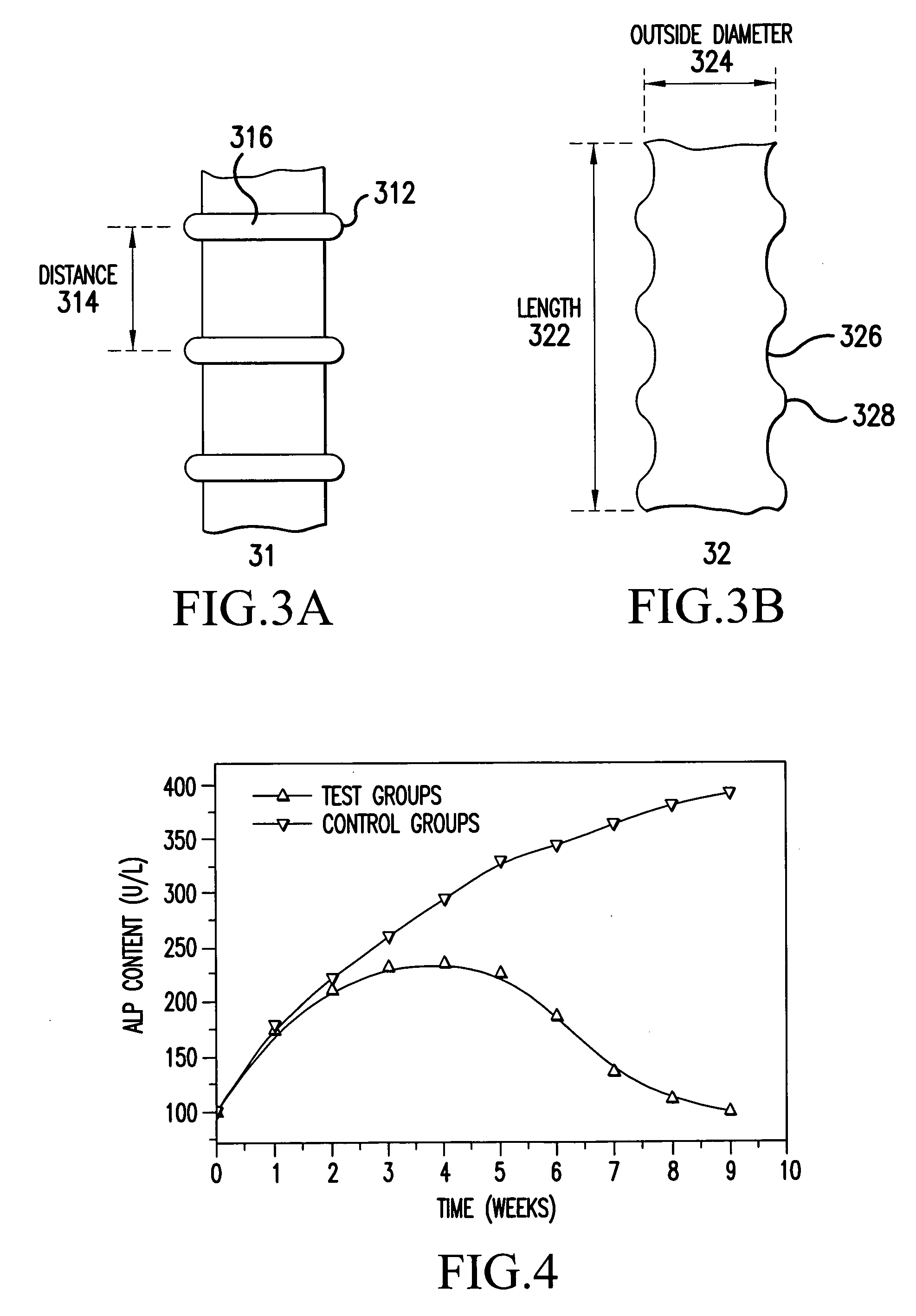 Biodegradable common bile duct stent and the method for preparing thereof