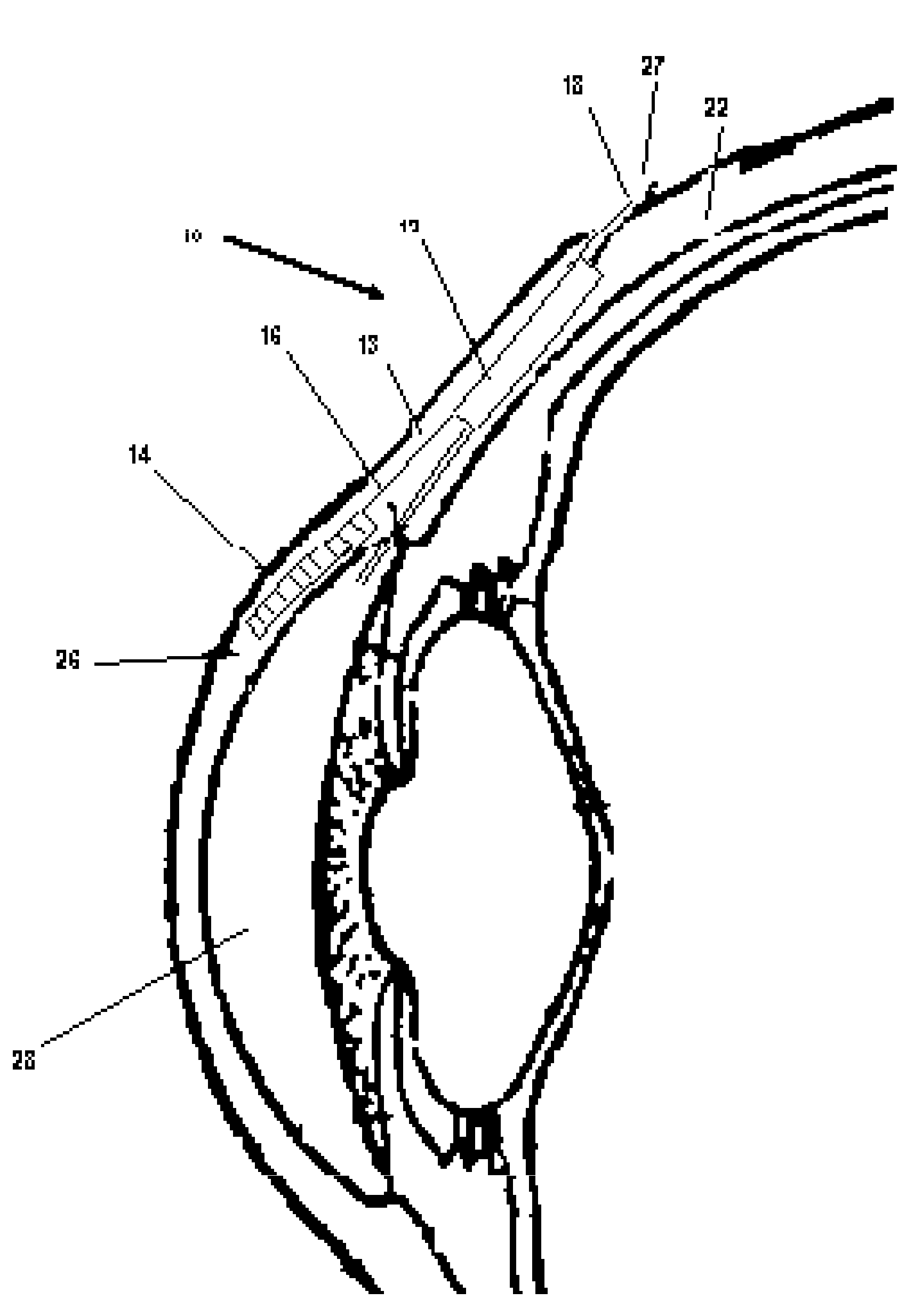 Apparatus and method for lowering intraocular pressure in an eye