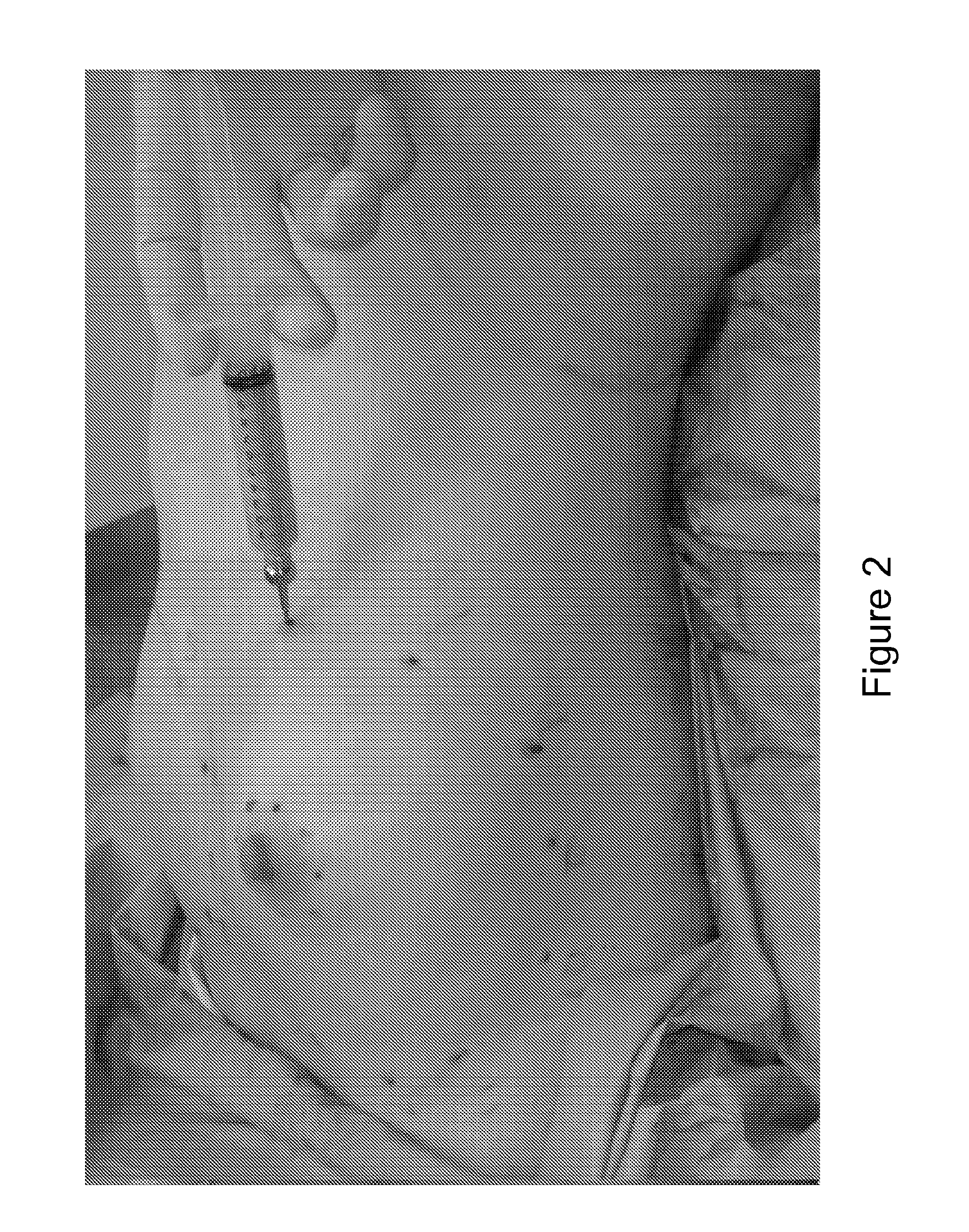 Method and system for preparing soft tissue for grafting, enhancing grafting results, and grafting autologous fat and adipocyte derived stem cells to soft tissue such as the breast and other tissue defects