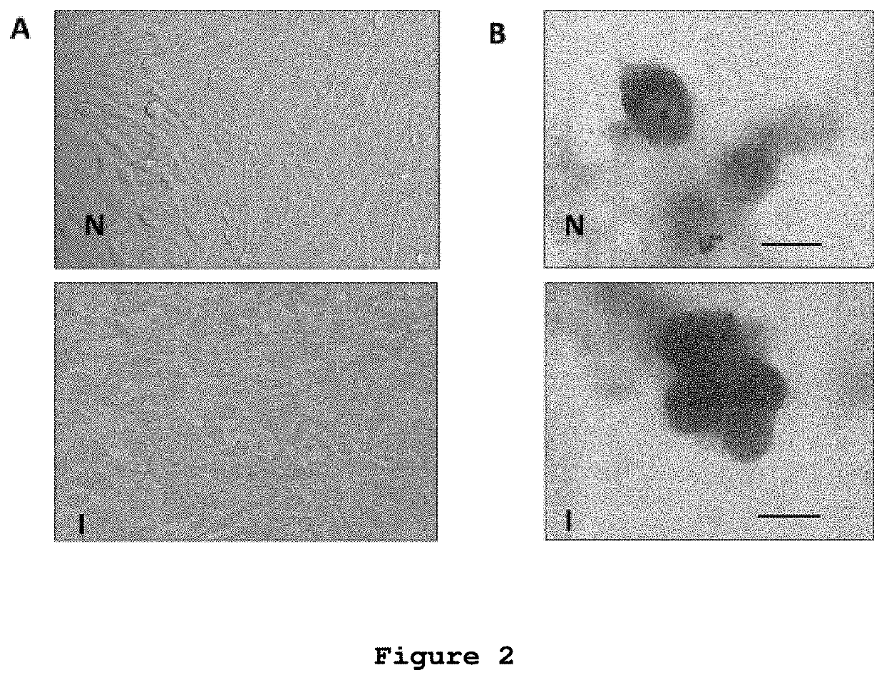 Vaccination with microvesicles derived from tumour cells for cancer treatment