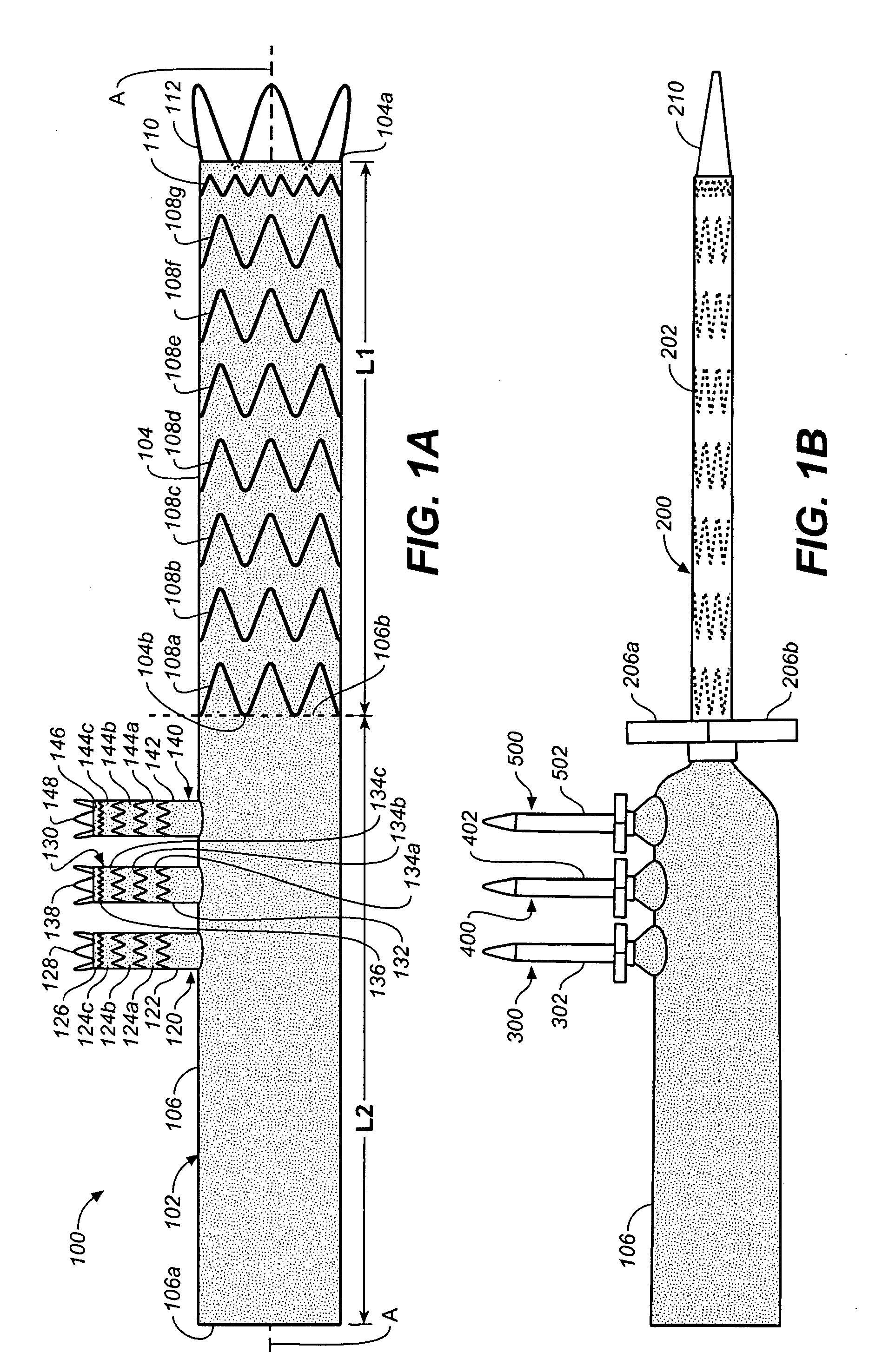 Prosthesis for antegrade deployment