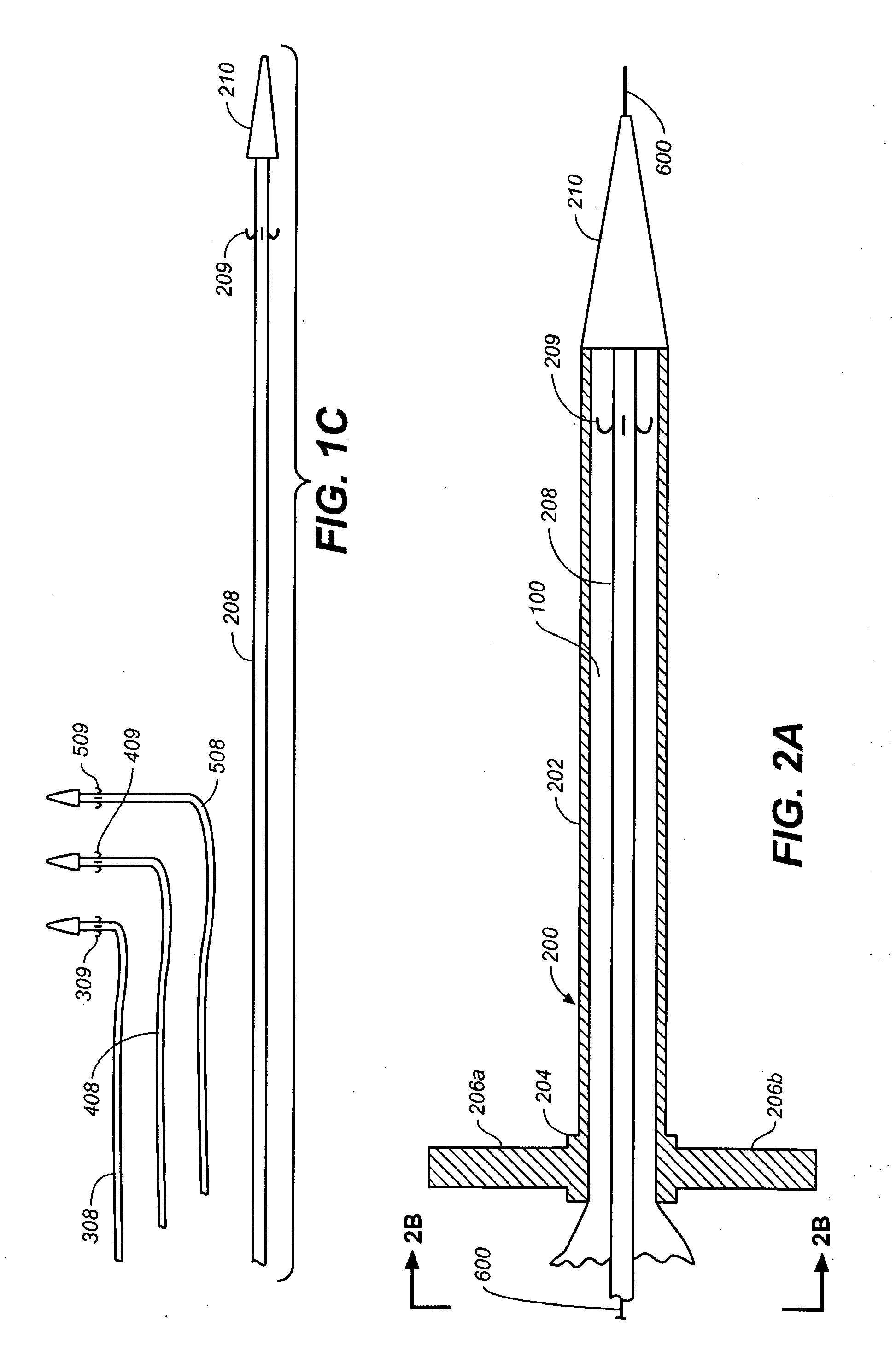 Prosthesis for antegrade deployment