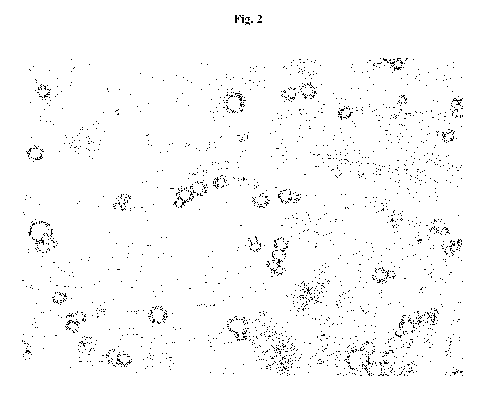 Pharmaceutical compositions comprising phosphate-binding polymer