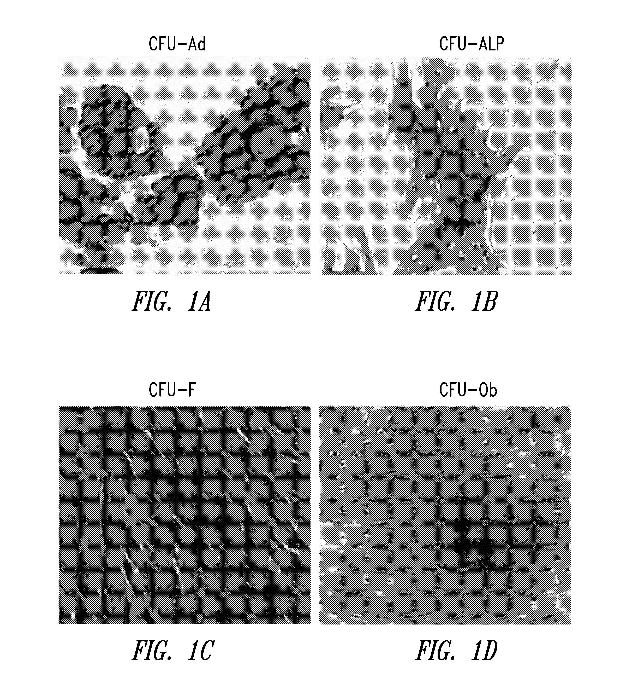 Immunophenotype and immunogenicity of human adipose derived cells