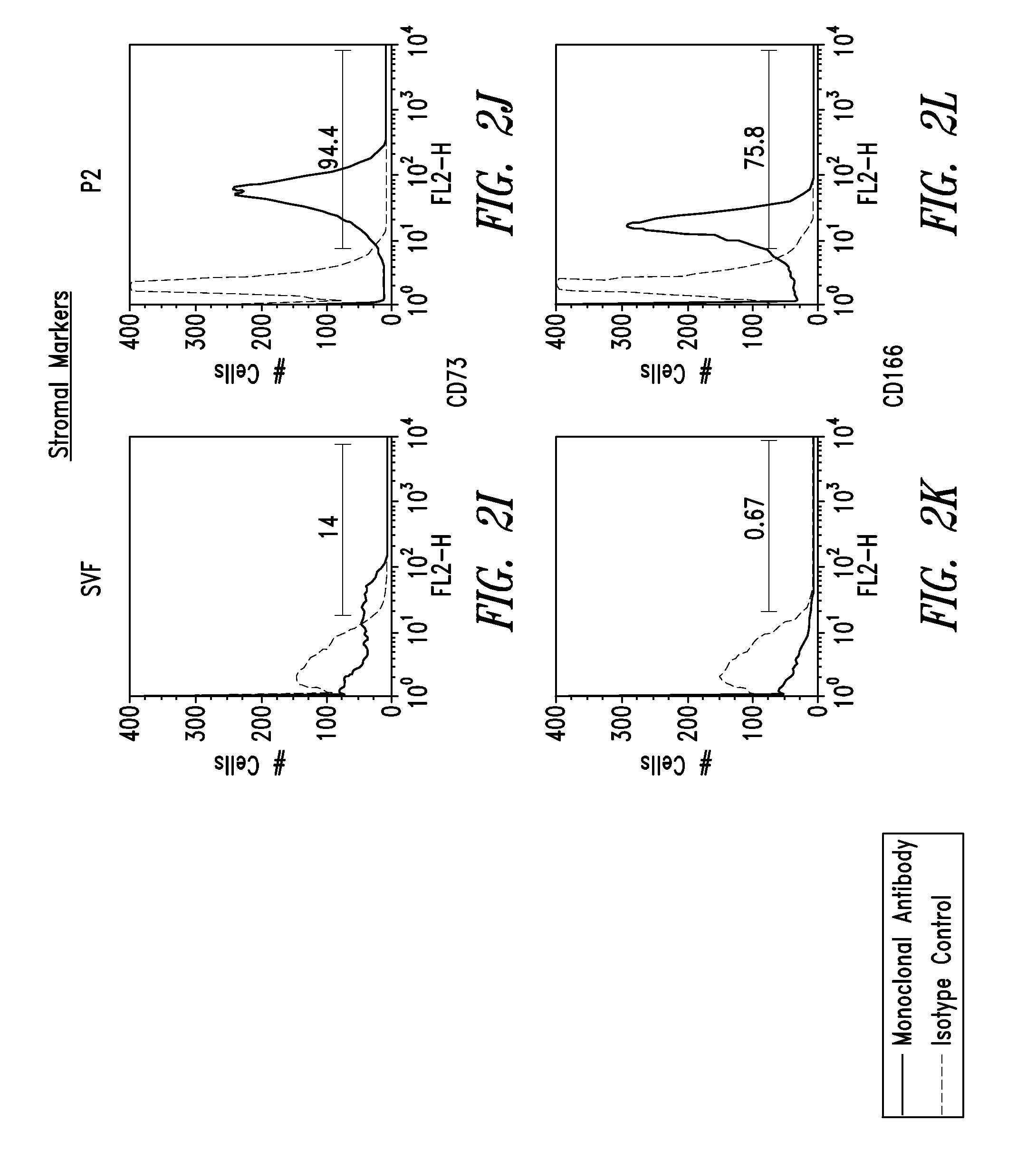 Immunophenotype and immunogenicity of human adipose derived cells