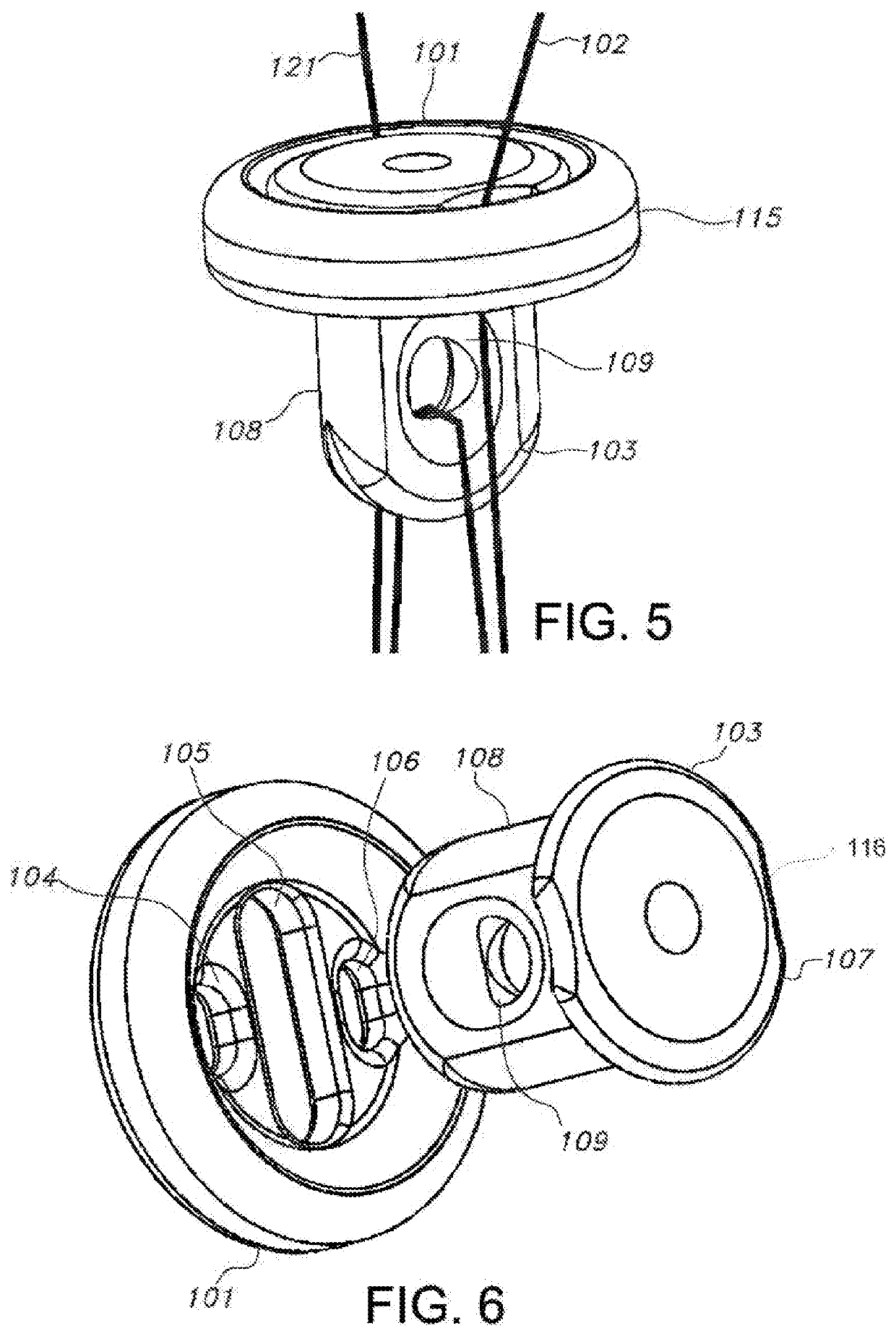 Knotless orthopedic stabilization system