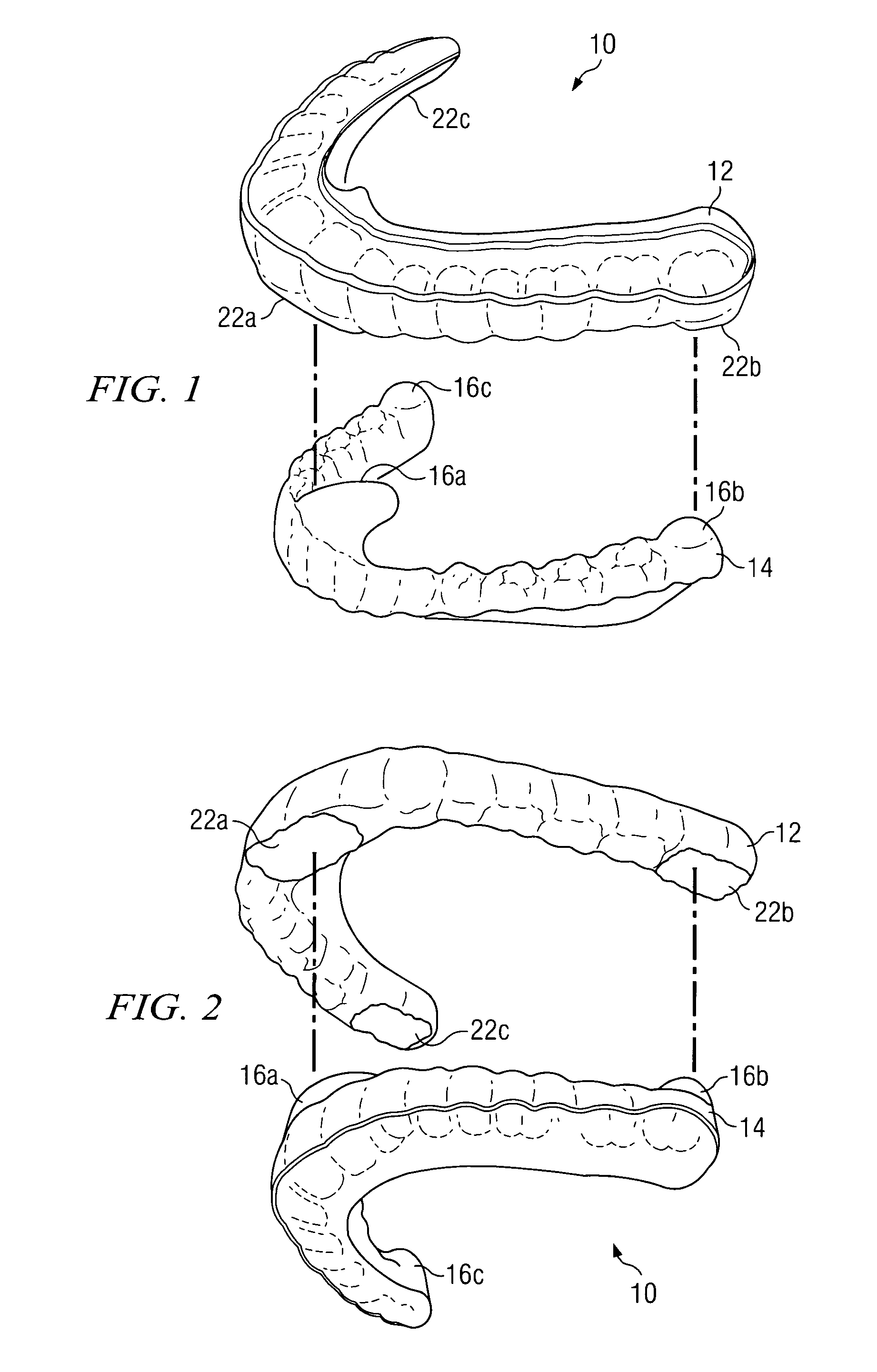 Oral appliance for maintaining stability of one or more aspects of a user's masticatory system