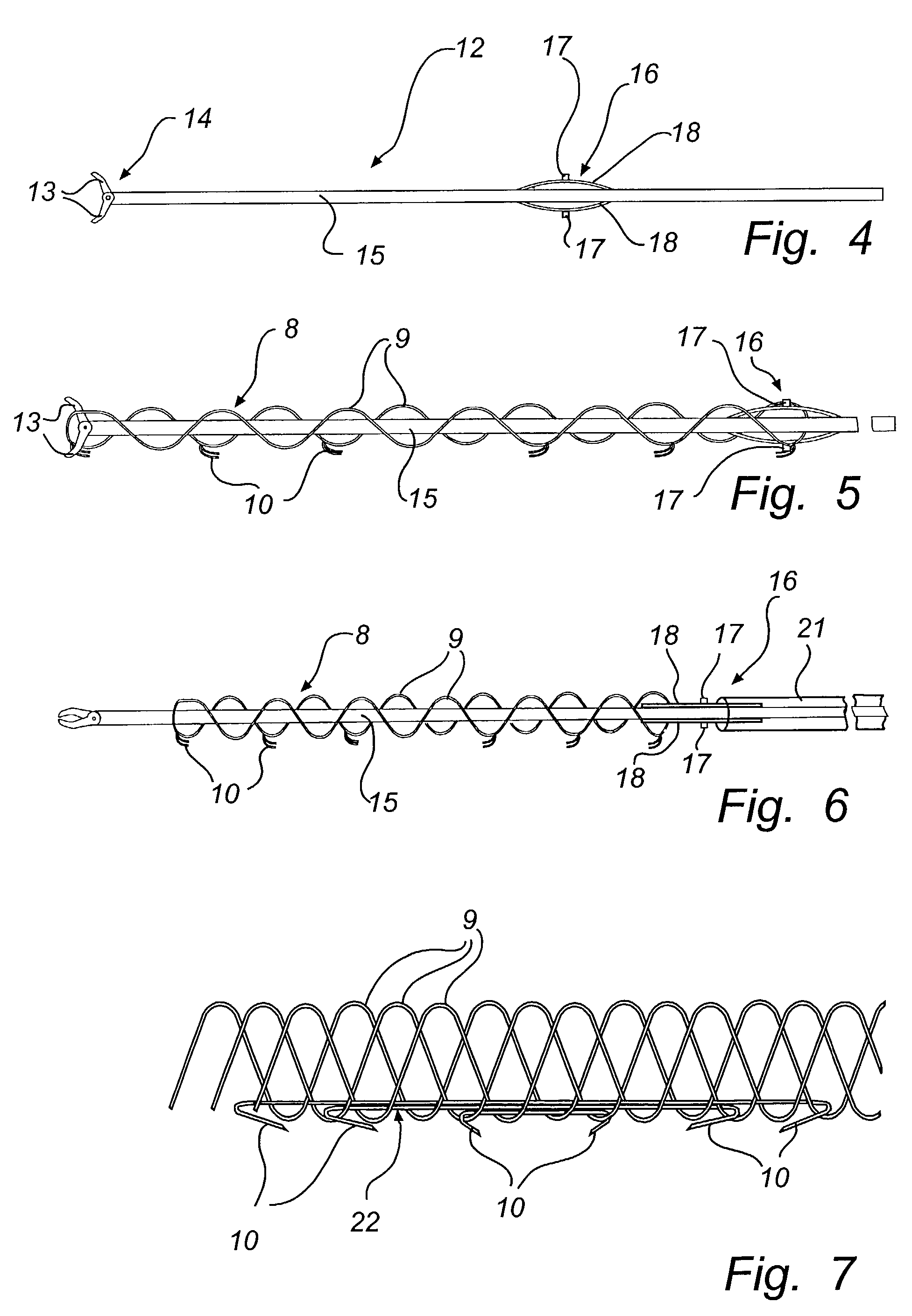 Method for treatment of mitral insufficiency