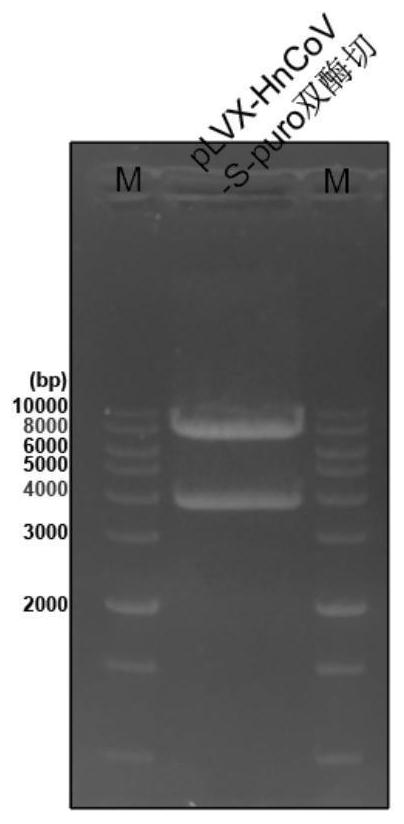 CRISPRi-mediated exosome for inhibiting scar formation as well as preparation method and application thereof