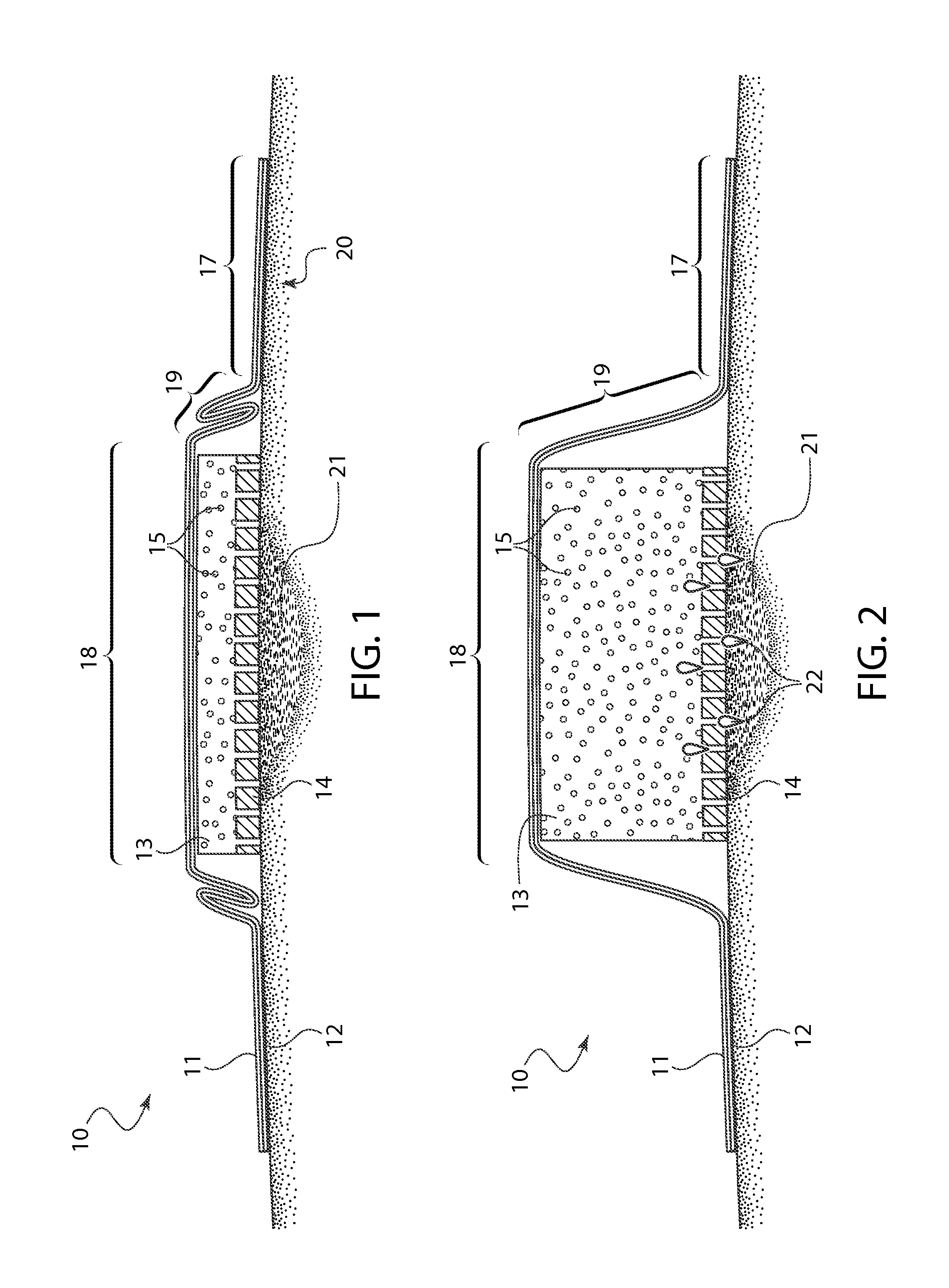 Bandage with a compressed layer that expands upon contact with liquid