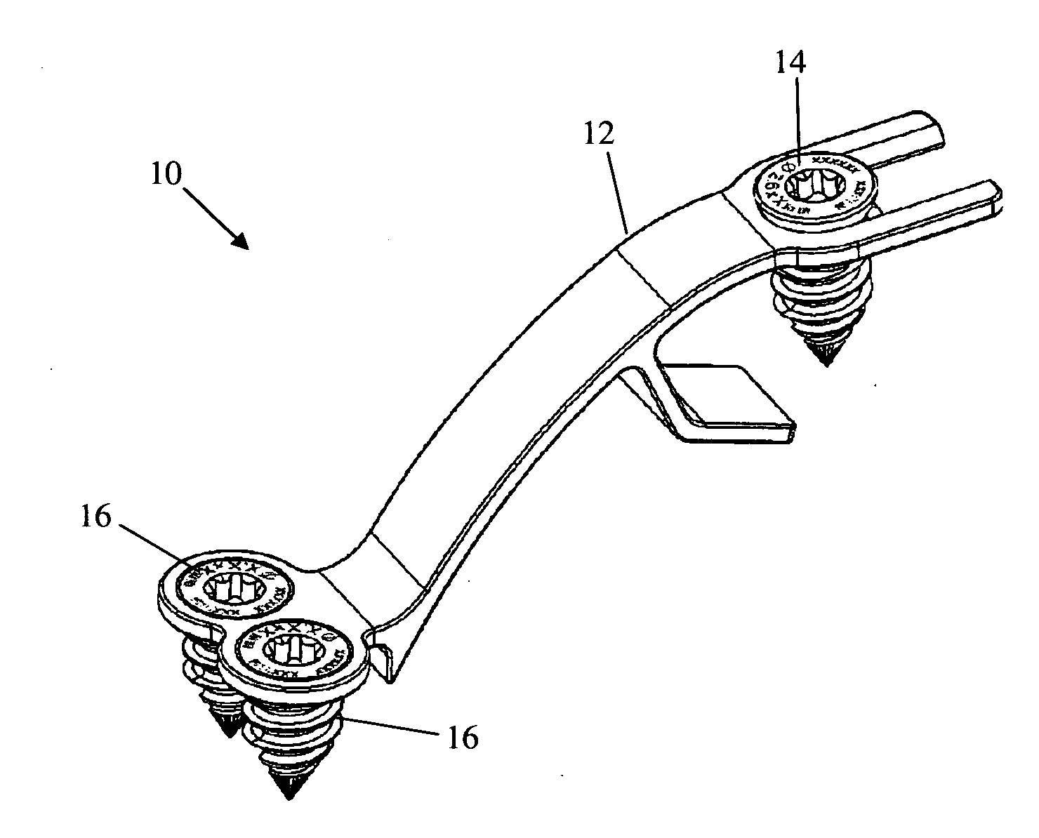 Bone plate system and related methods