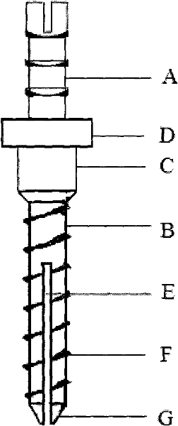 Titanium alloy elastic preformation root canal pile with low elasticity modulus