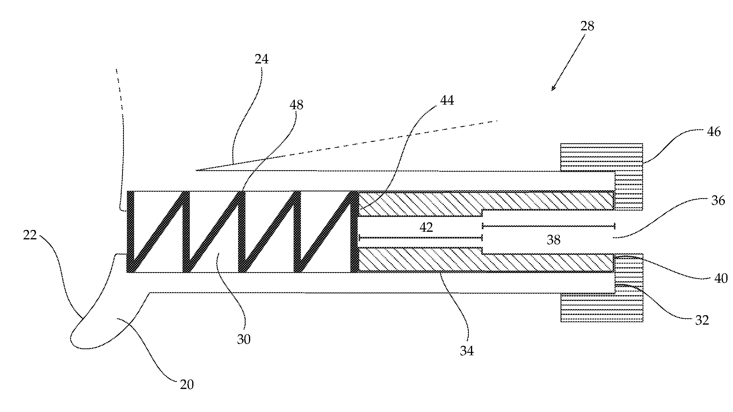 Subretinal delivery of therapeutic compositions