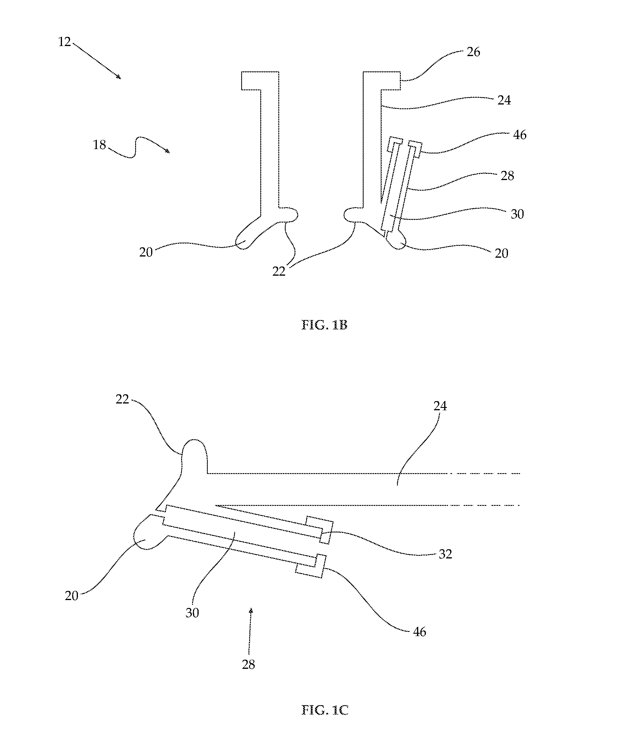 Subretinal delivery of therapeutic compositions