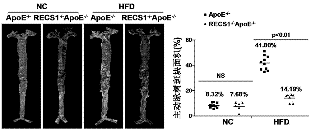 Function and application of blood shear stress responding protein 1 in treatment of atherosclerosis