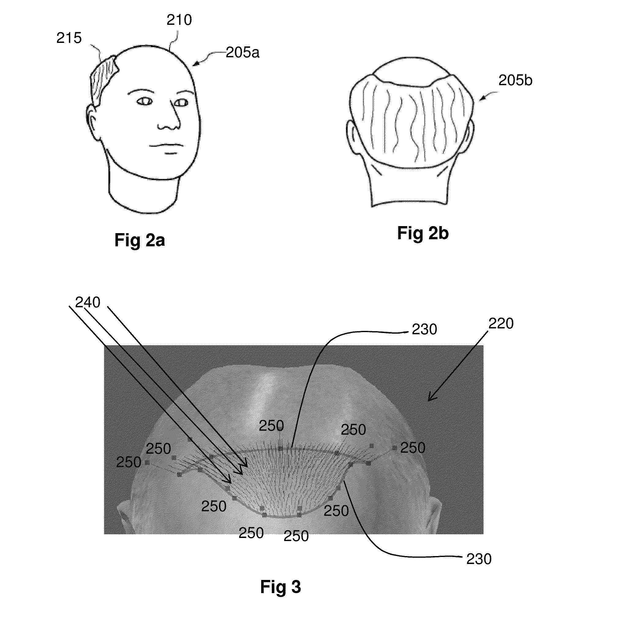 Systems and Methods for Planning Hair Transplantation