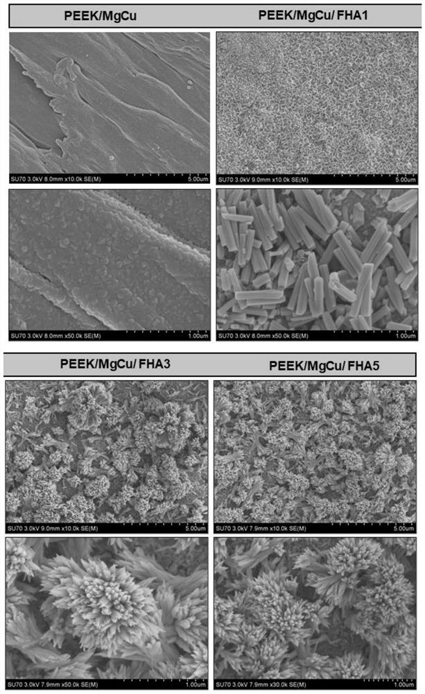 PEEK abutment with nanoneedle interface and preparation method of PEEK abutment