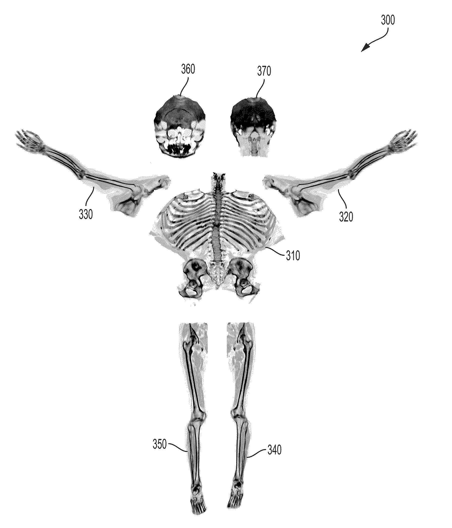 Visualization Method for a Human Skeleton from a Medical Scan