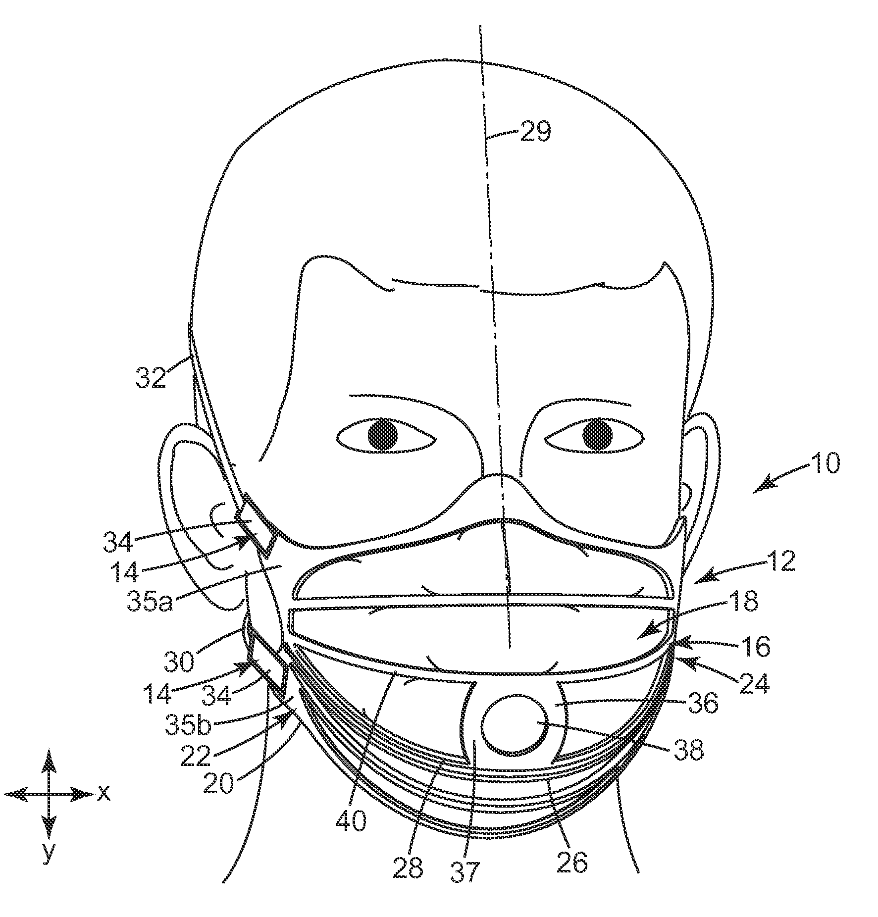 Filtering face-piece respirator that has expandable mask body