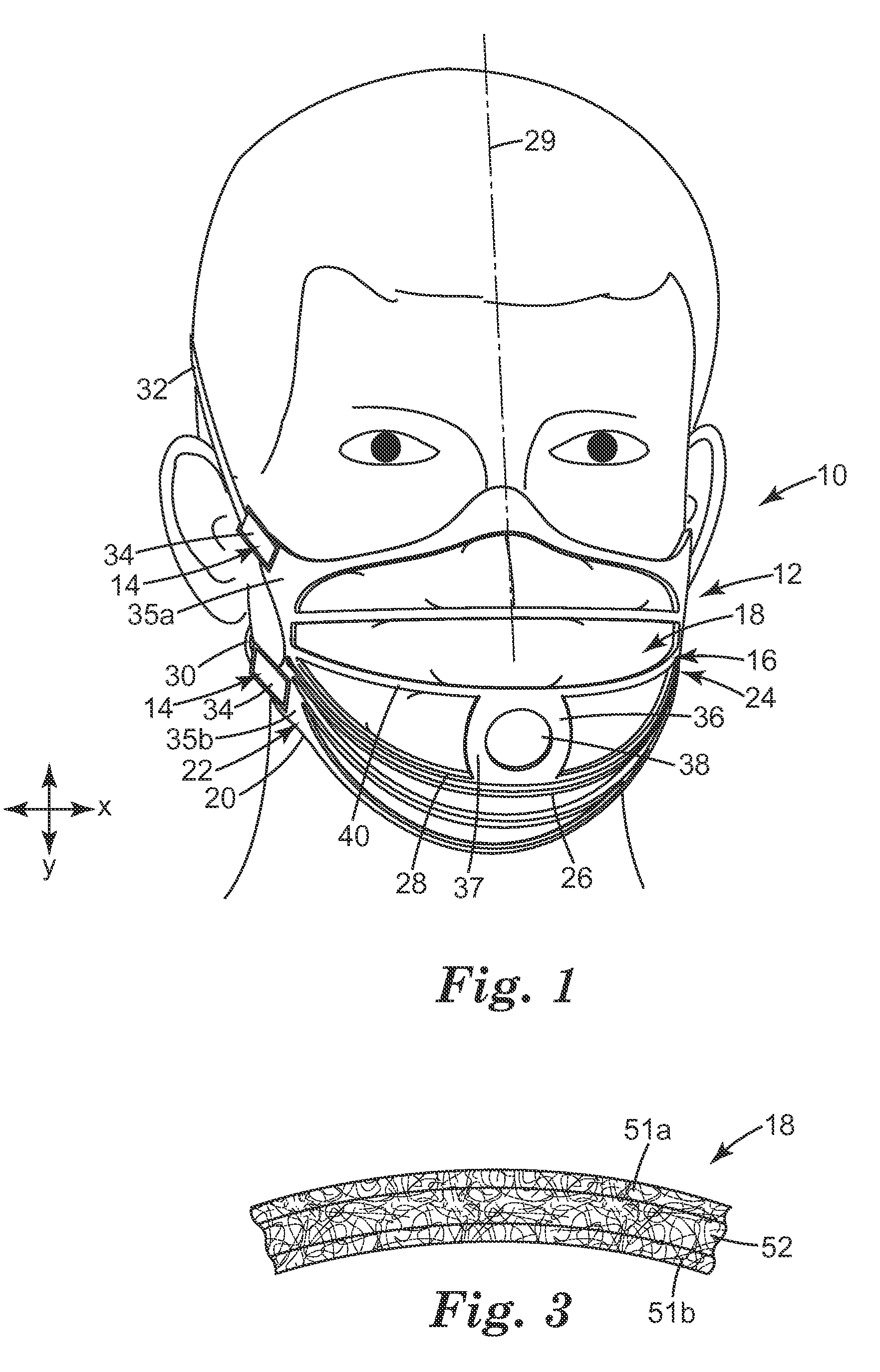 Filtering face-piece respirator that has expandable mask body