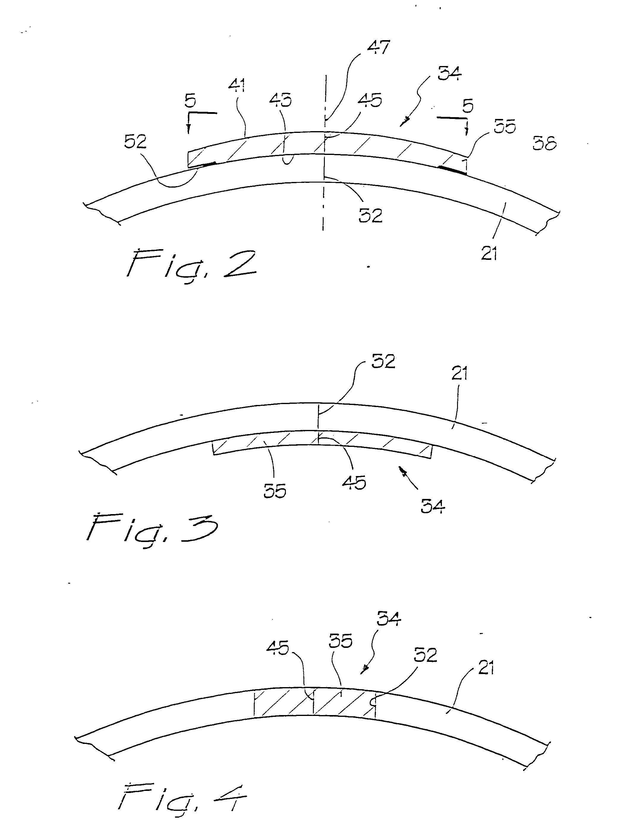 Surgical access apparatus and method