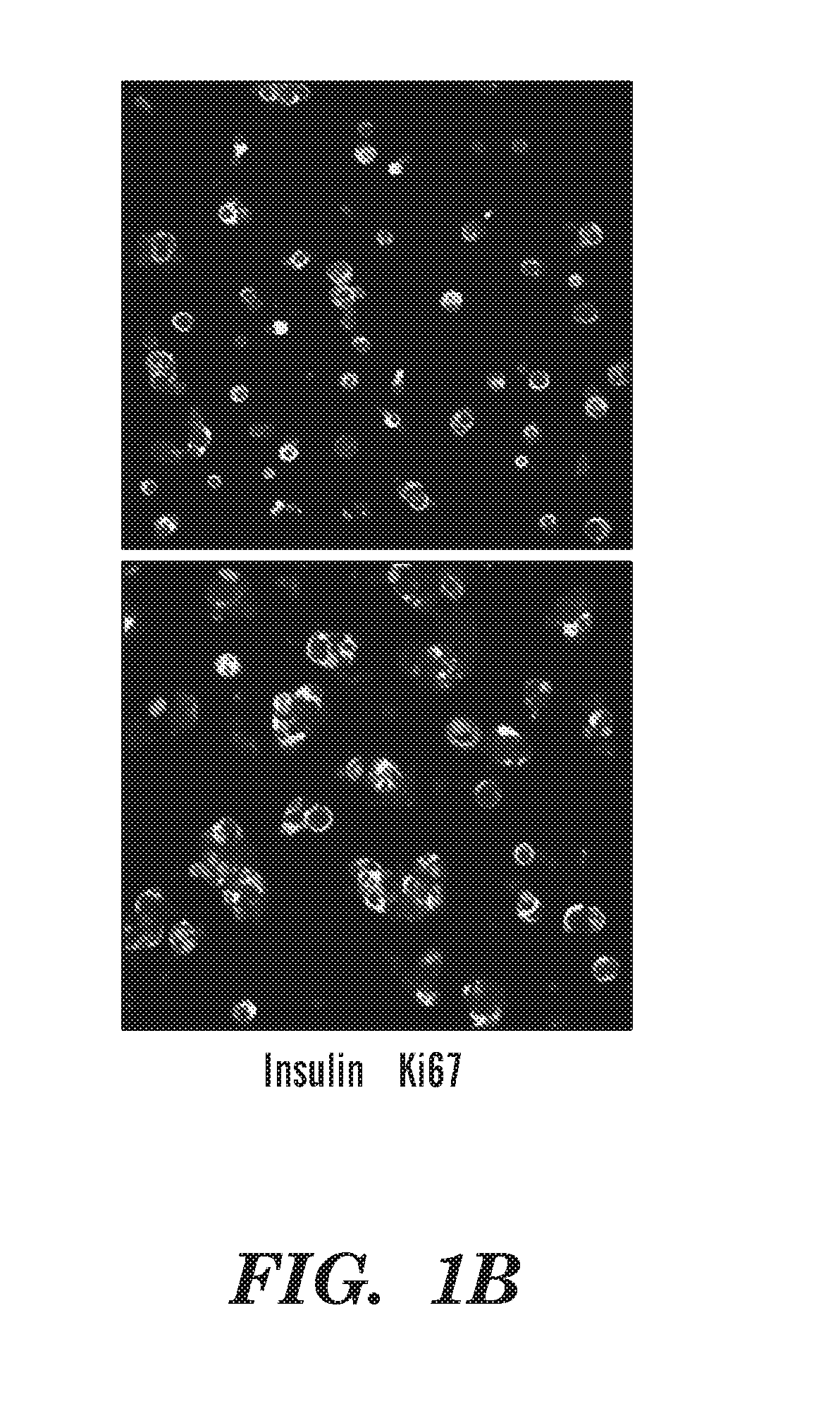 Method for increasing cell proliferation in pancreatic beta cells, treatment method, and composition