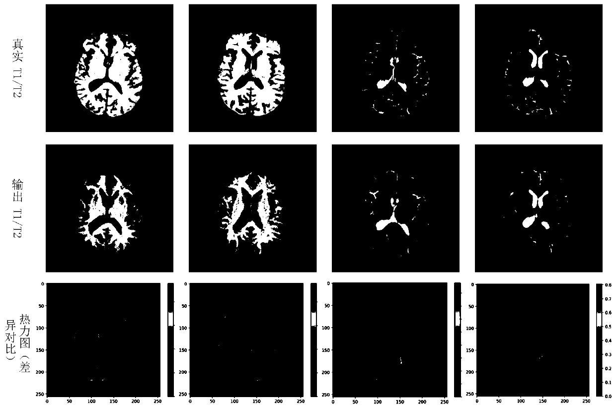Multi-modal brain MRI image bidirectional conversion method based on multi-generation and multi-confrontation