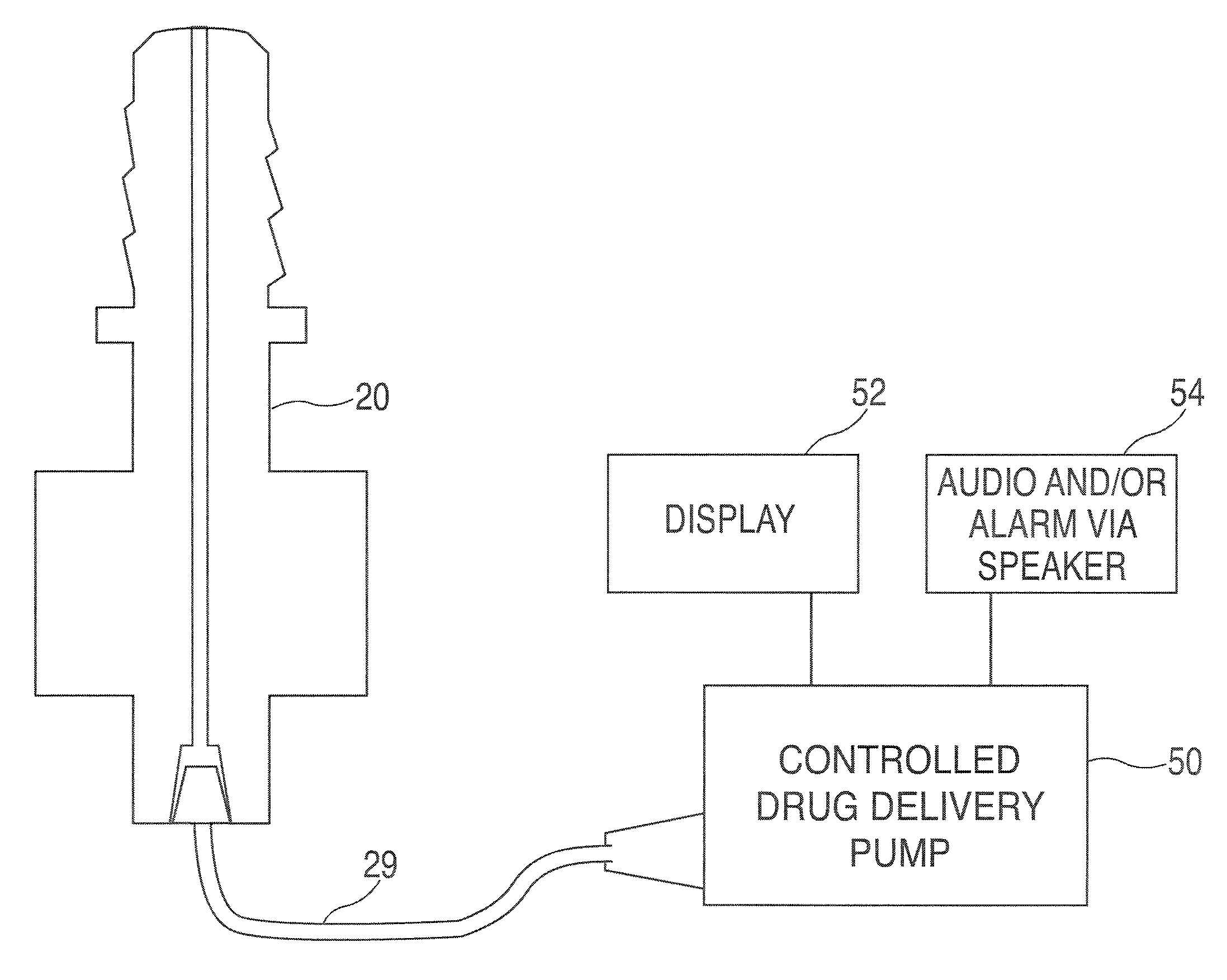 Method and apparatus for performing maxillary sinus elevation