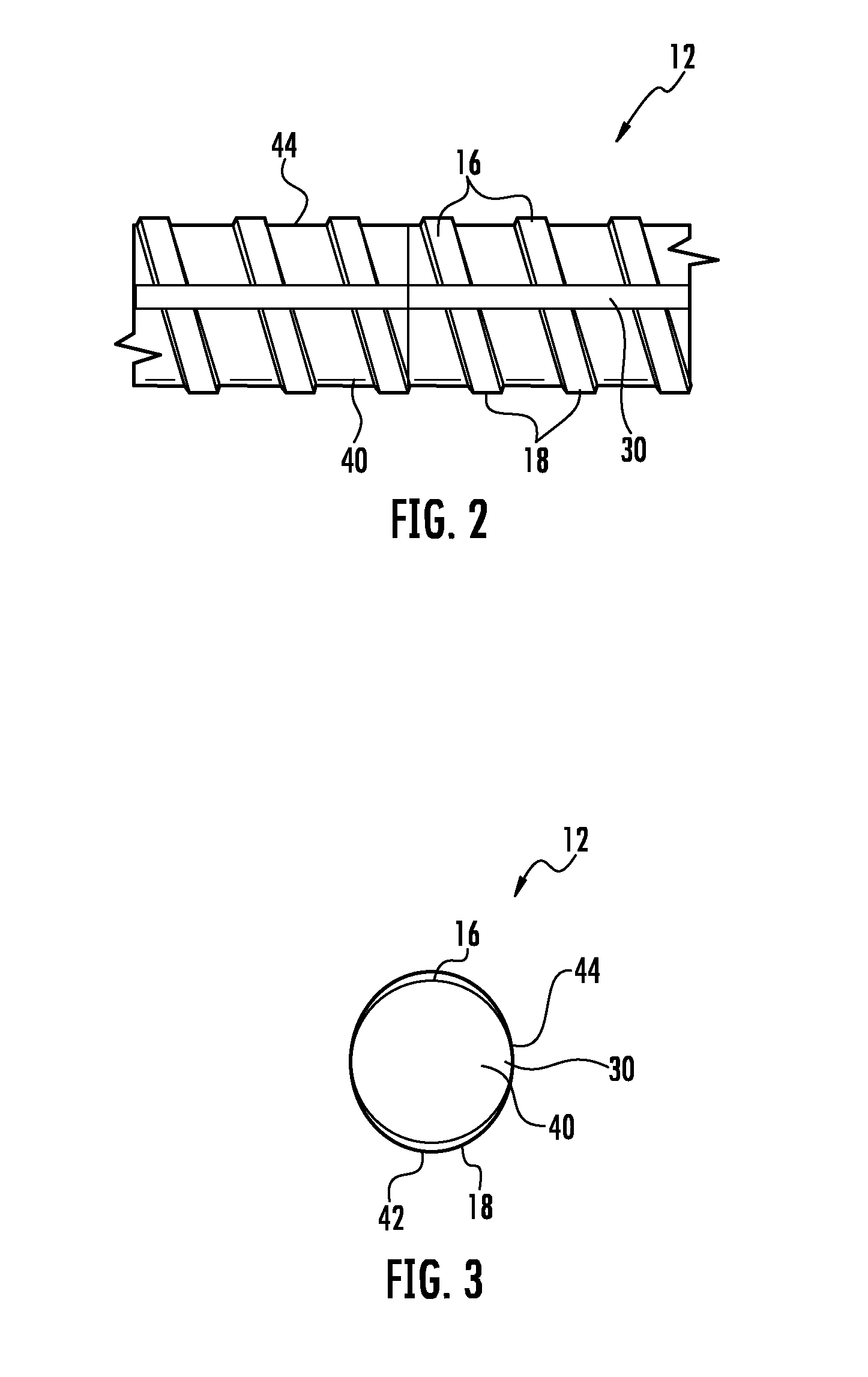 Tensionable threaded rebar bolt