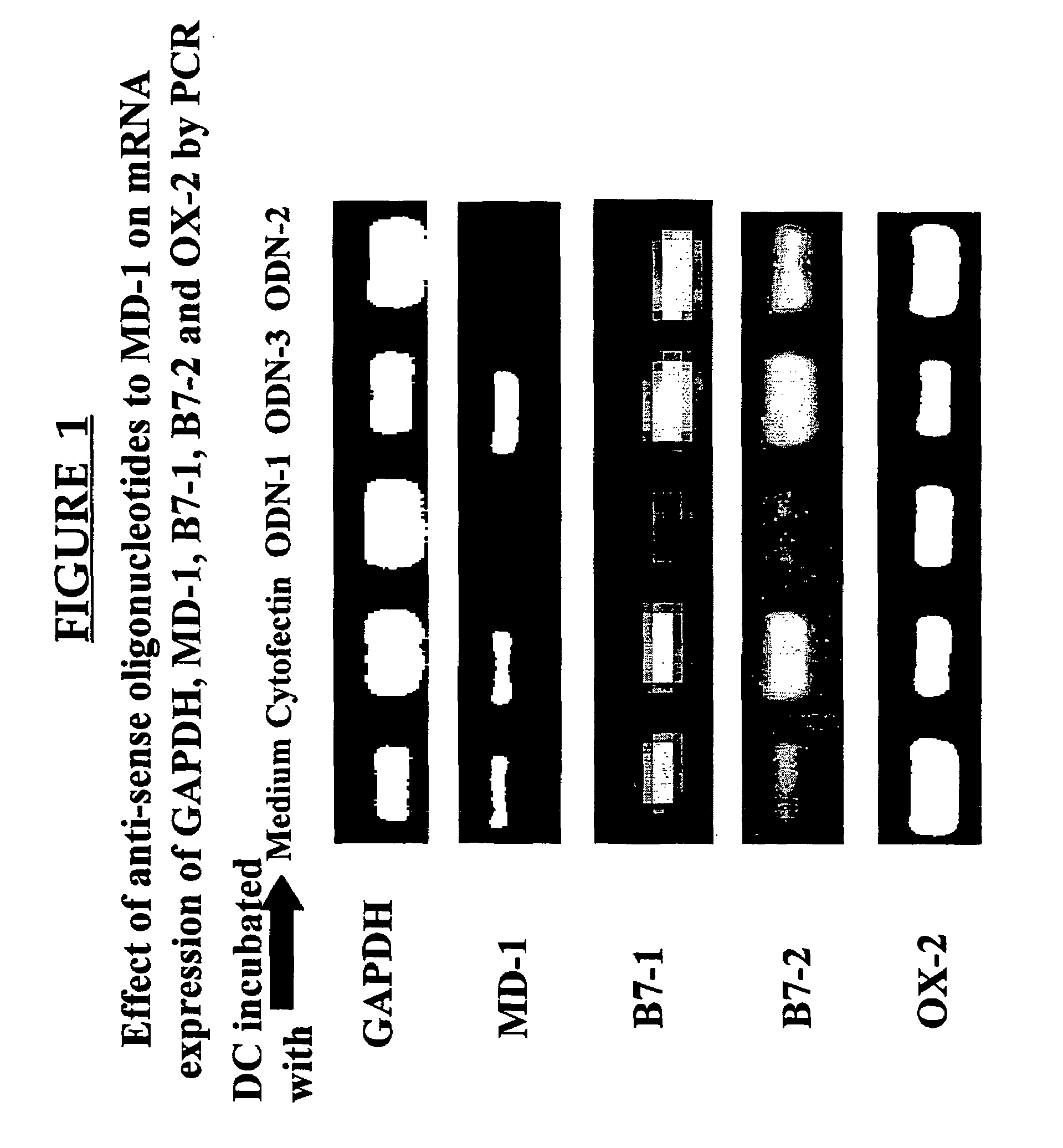 MD-1 inhibitors as immune suppressants