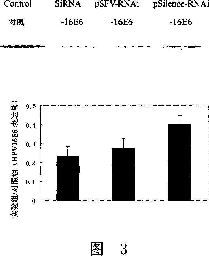 RNAi vector and its application