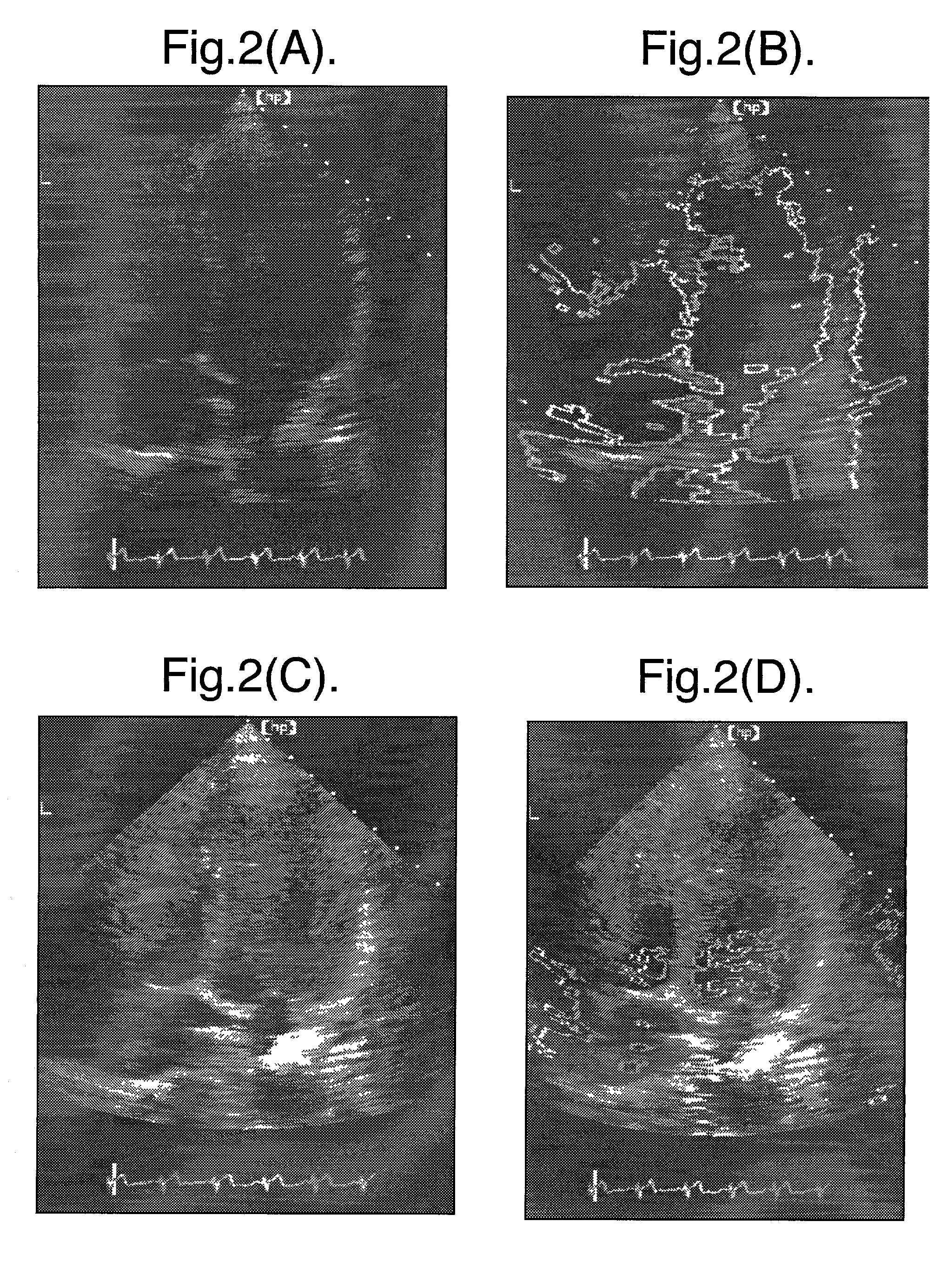 Non-rigid motion image analysis