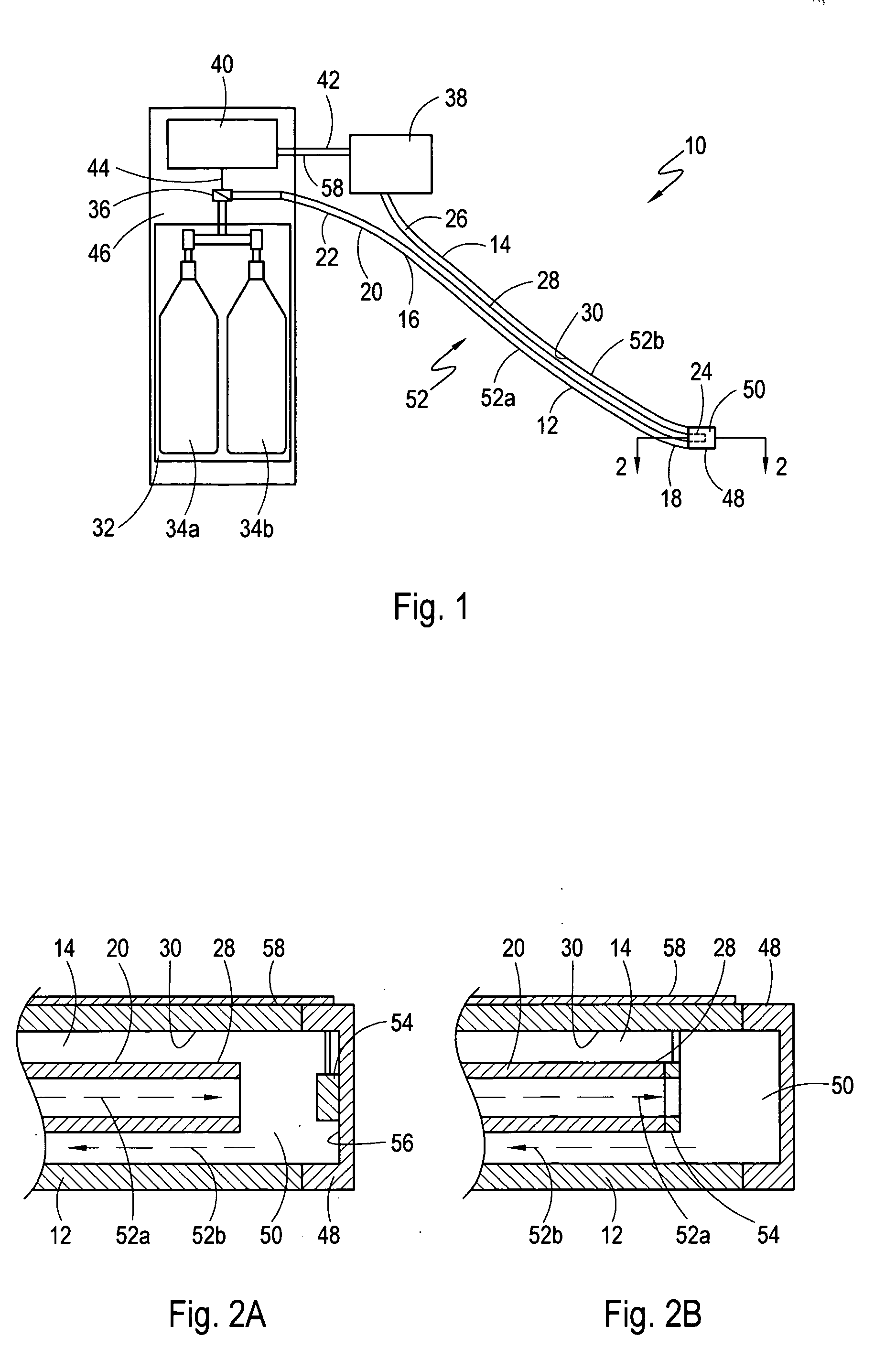 System for detecting leaks and occlusions in a cryoablation catheter